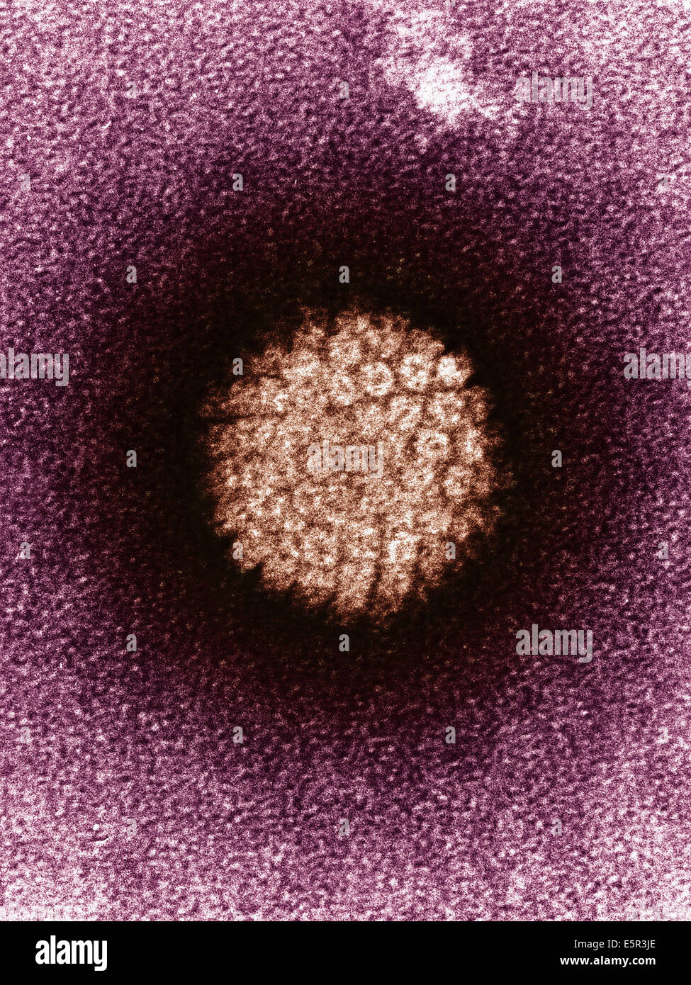 Colored transmission electron micrograph (TEM) of human papillomavirus (HPV), The HPV is involved in the development of Stock Photo