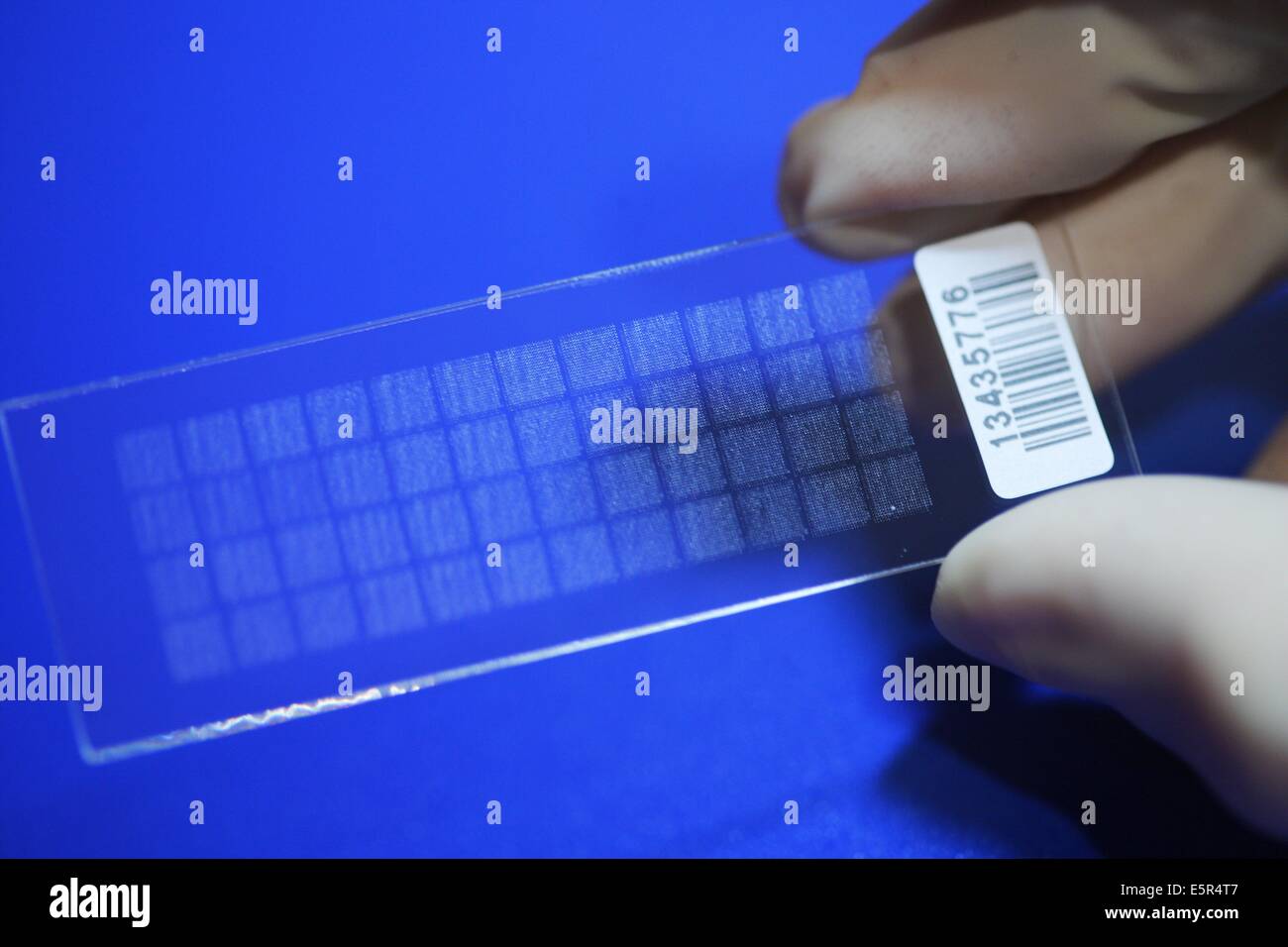 DNA chip containing the genome of an obese person, Research team of Pr Katrine Clément on nutrition and health, INSERM U872, Stock Photo