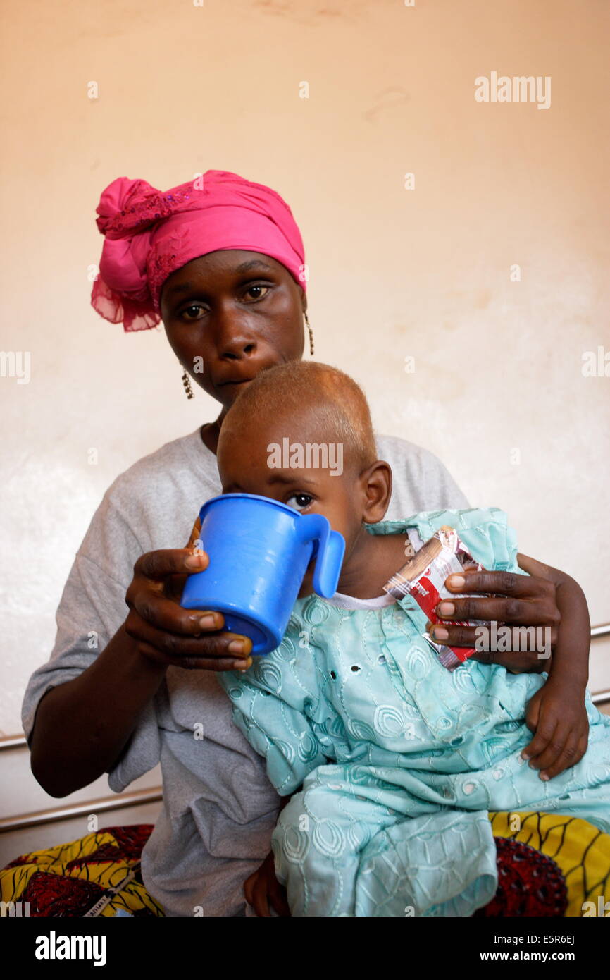 Appetite test : woman giving her child a ration of Plumpy nut, peanut-based therapeutic food Program of ambulatory treatment of Stock Photo
