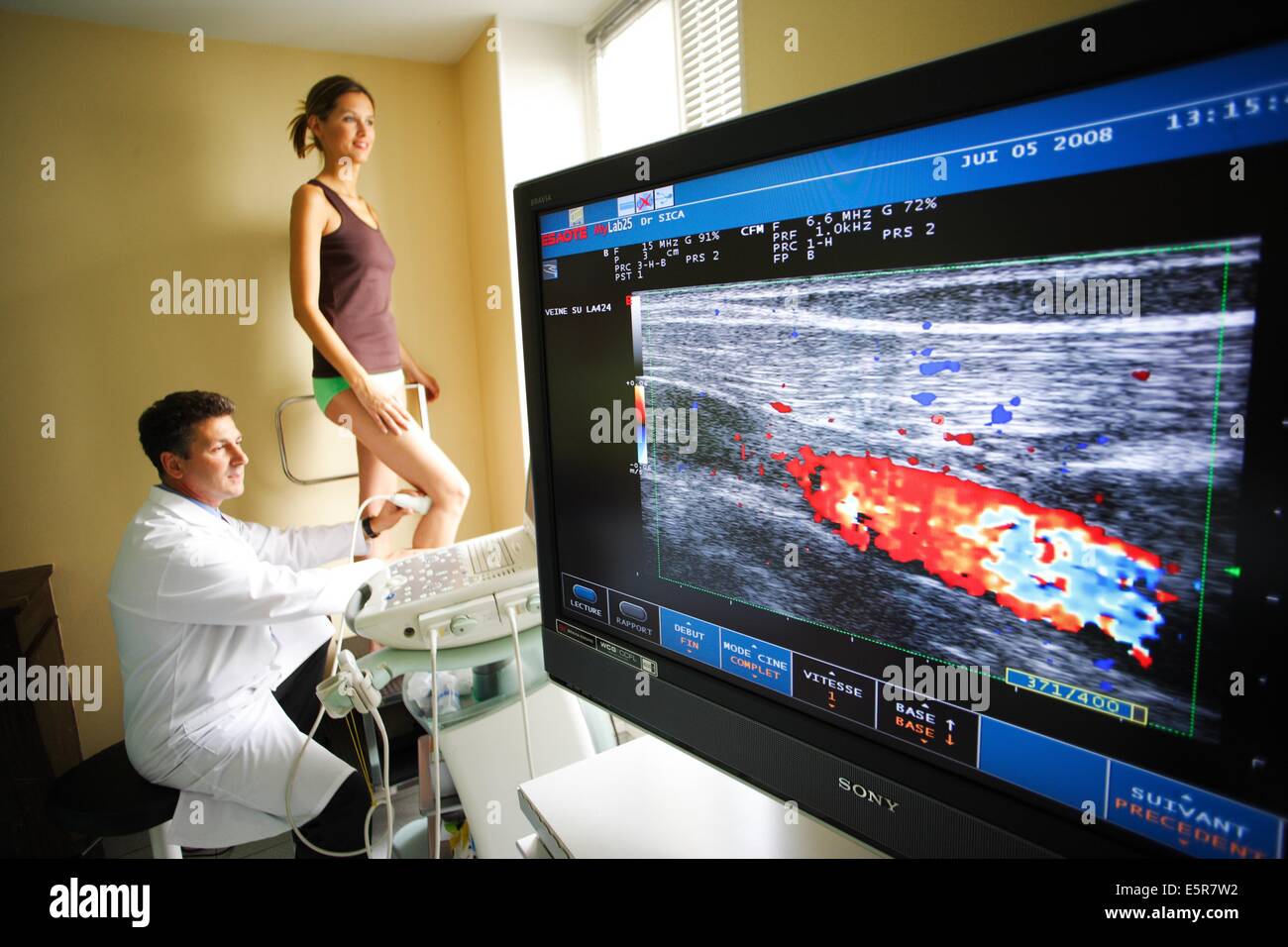 Doppler ultrasound - what is it in simple words 75 Doppler ultrasound - what is it in simple words 99