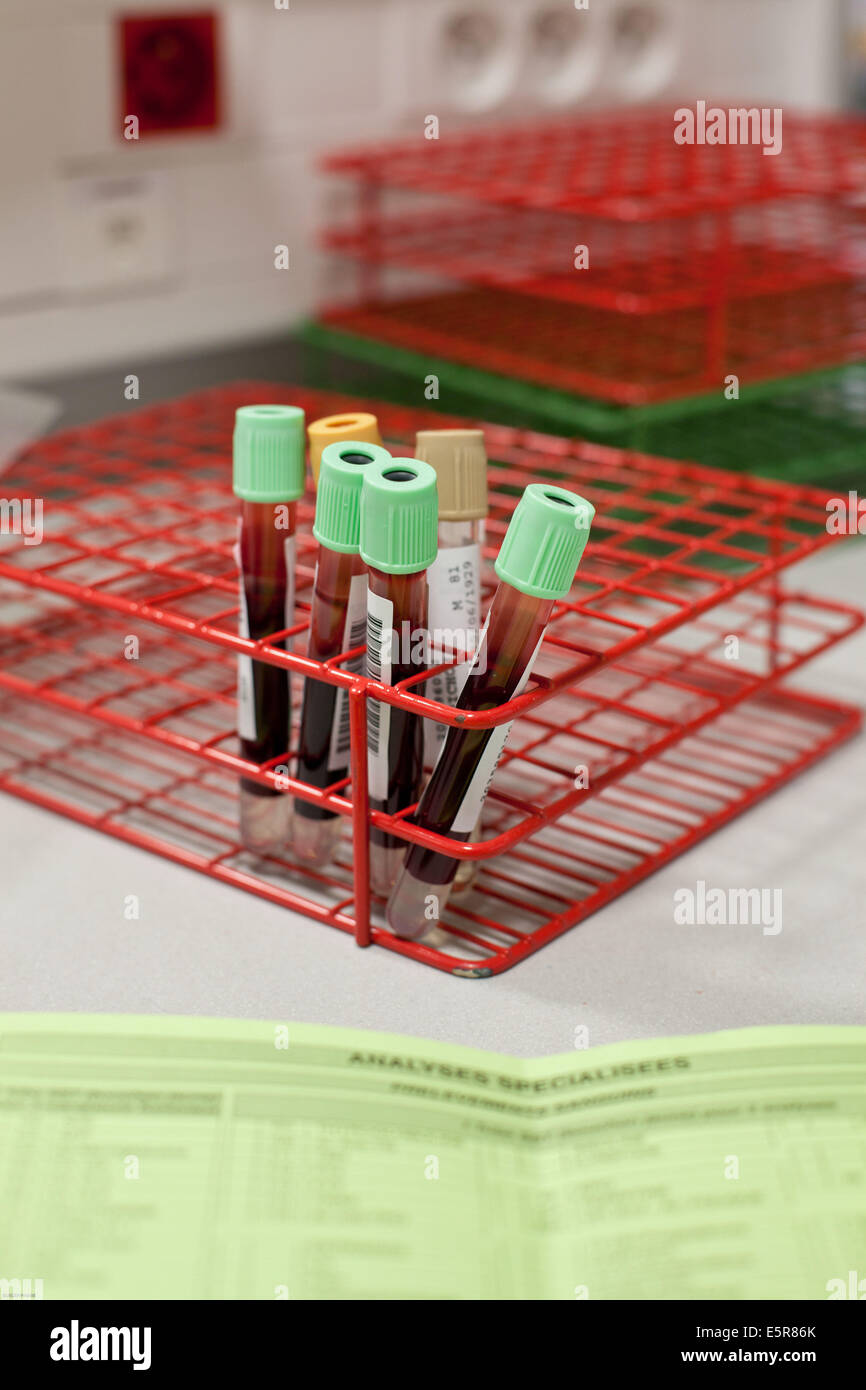 Blood samples. Stock Photo