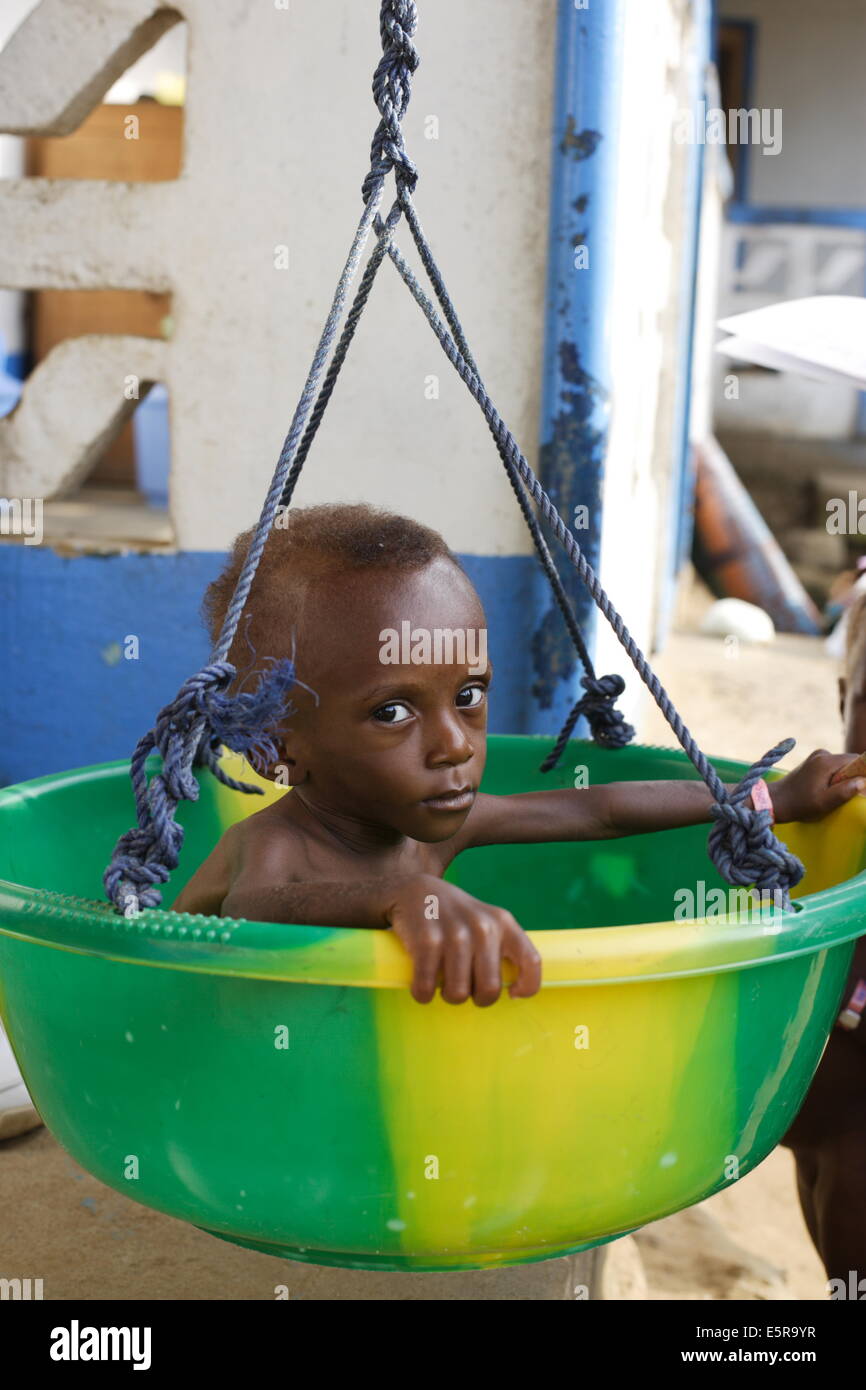 18 months old undernourished child being weighed in a therapeutic feeding center in Monrovia, Liberia, implemented by Action Stock Photo