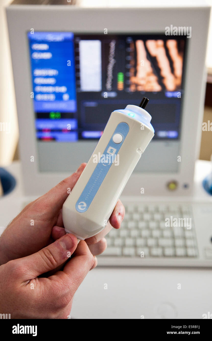 Fibroscan, diagnostic device allows to determine the stage of liver fibrosis due to hepatitis C or cirrhosis. Stock Photo