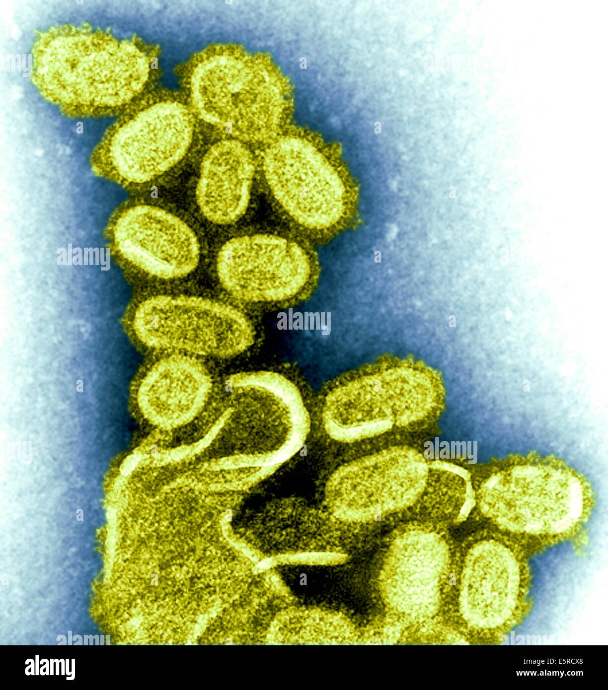 Transmission Electron Micrograph (TEM) of Spanish flu virus, this