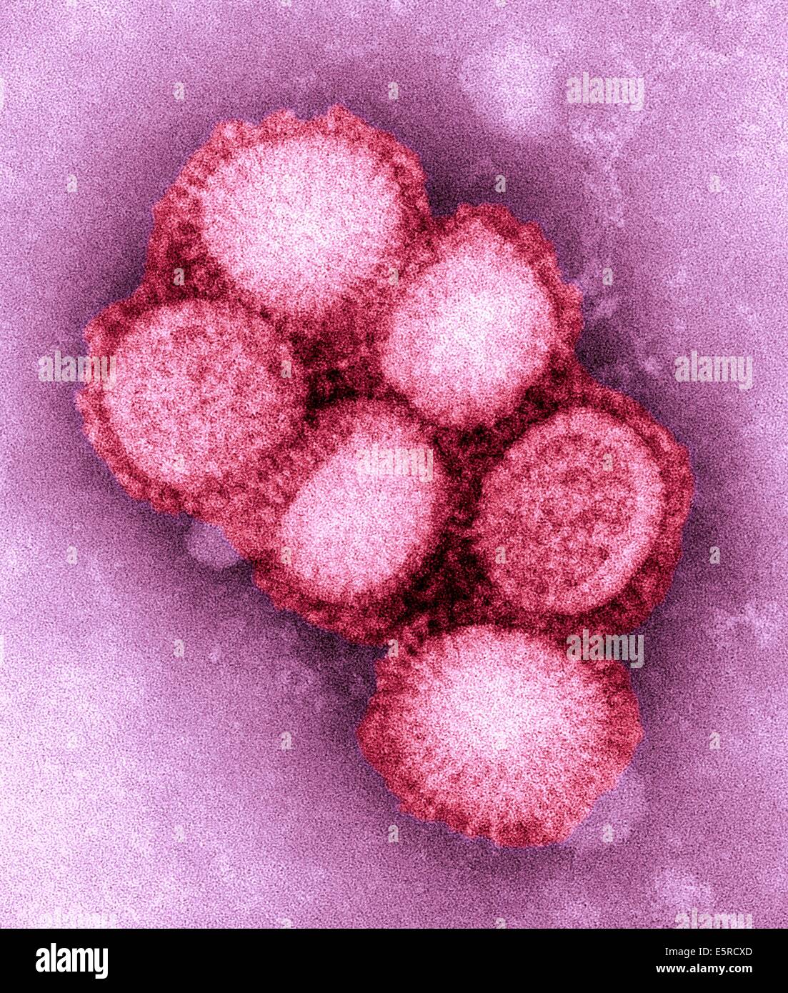 Swine Influenza (swine flu) is a respiratory disease of pigs caused by type A influenza virus that regularly causes outbreaks Stock Photo