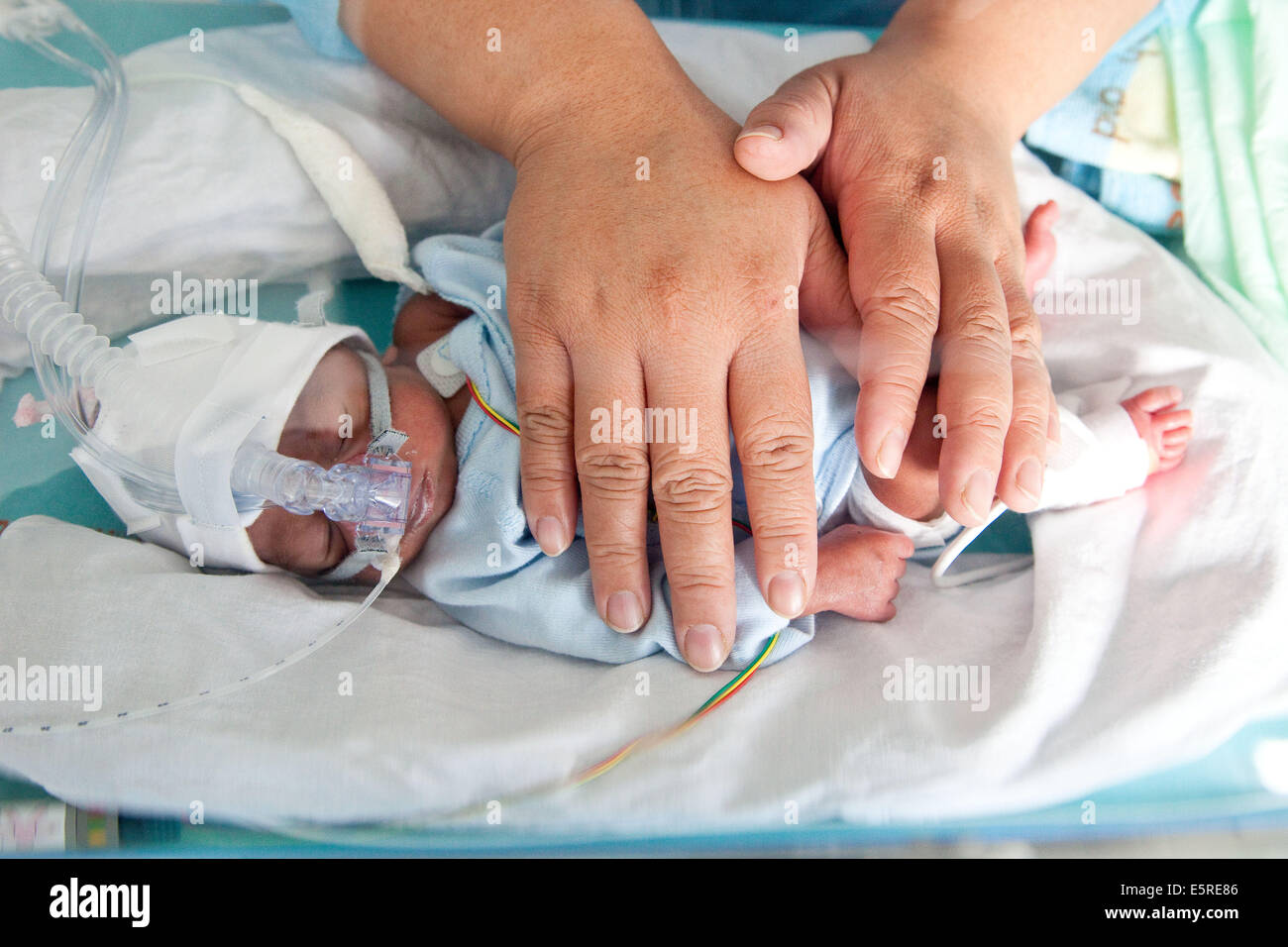 Premature newborn baby placed under respiratory assistance, mother putting her hands over her baby to quiet, Neonatalogy Stock Photo