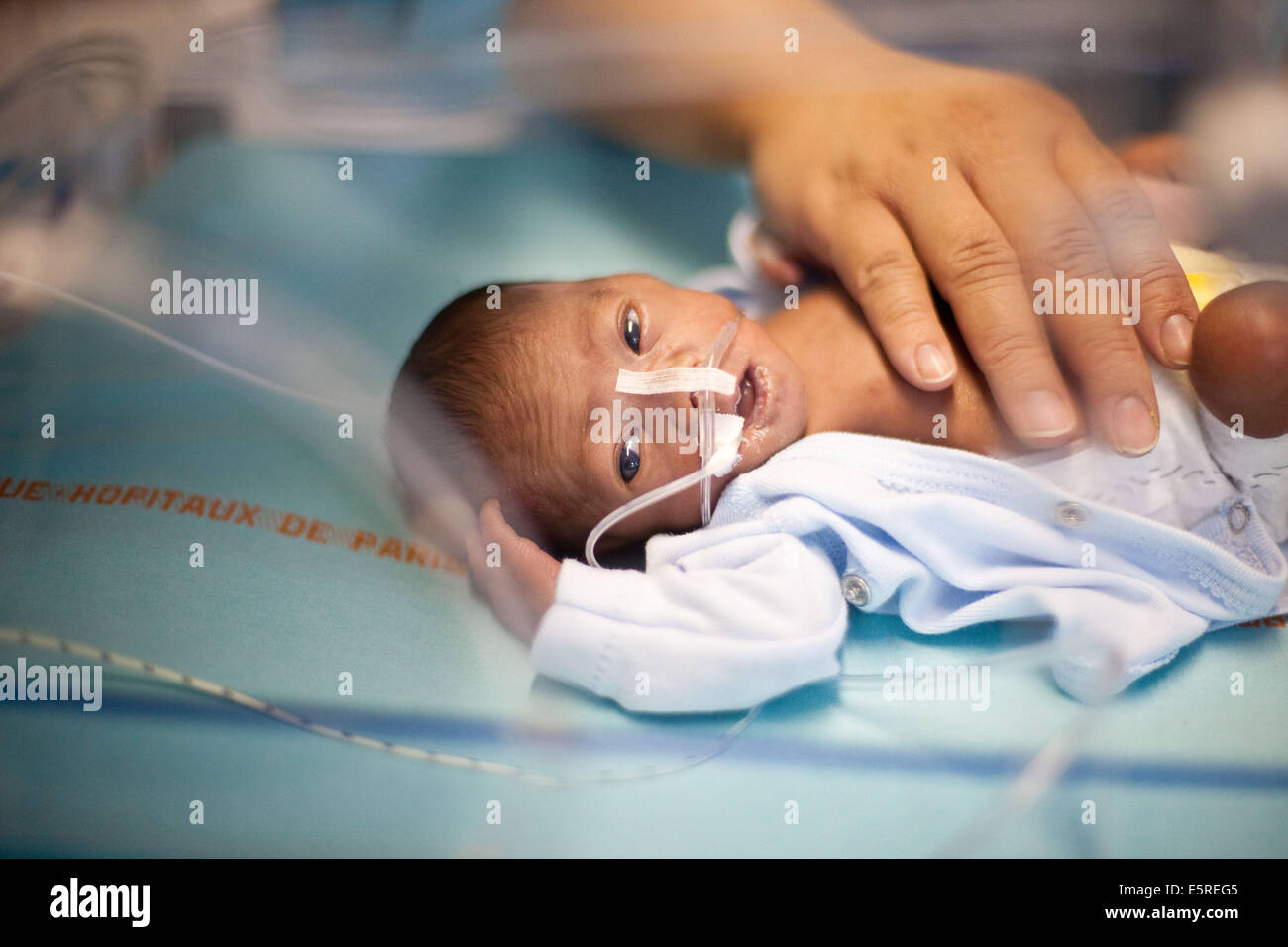 Premature newborn baby placed under respiratory assistance, Neonatalogy