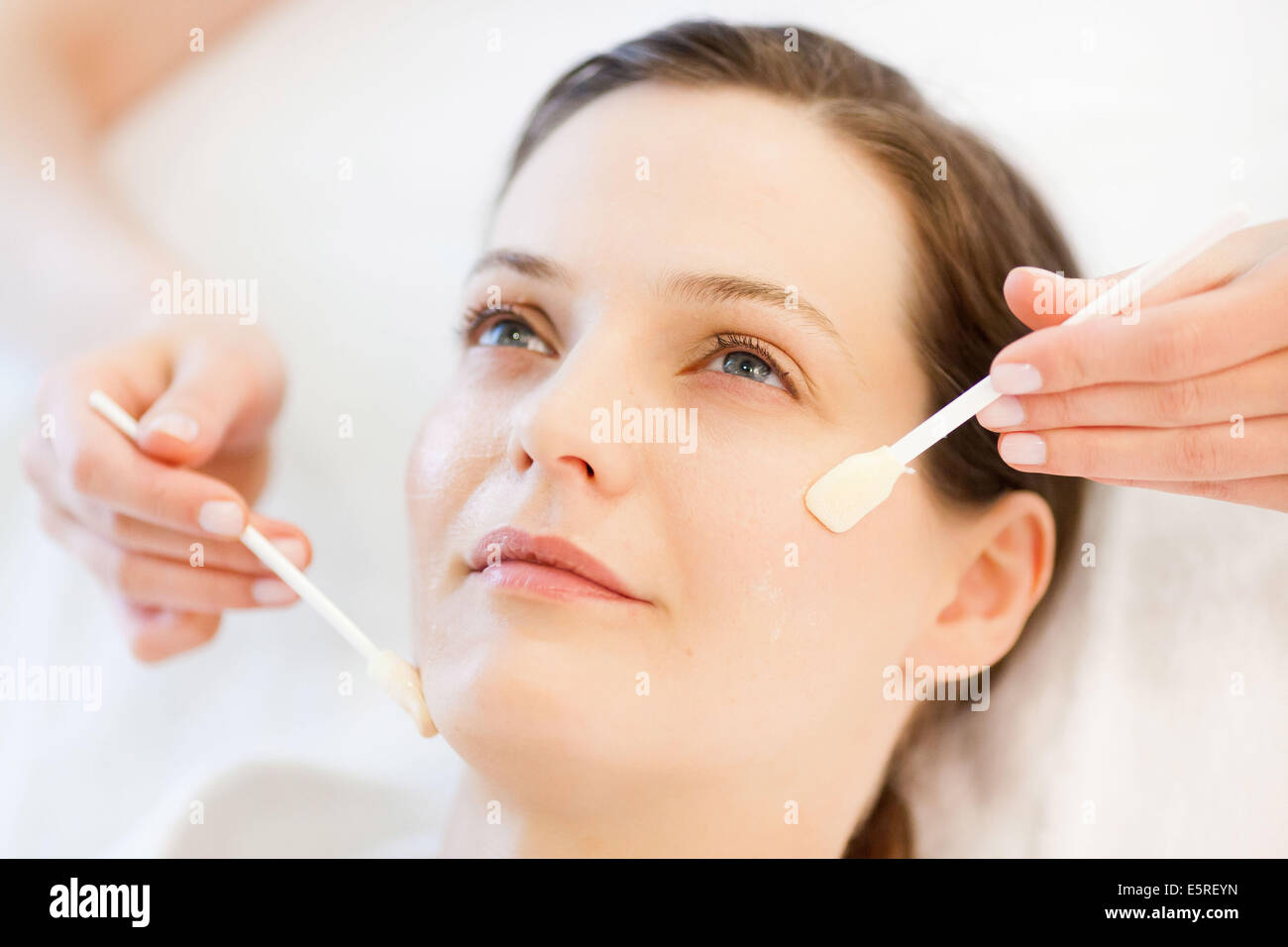 Skin peeling by application of a glycolic acid. Stock Photo