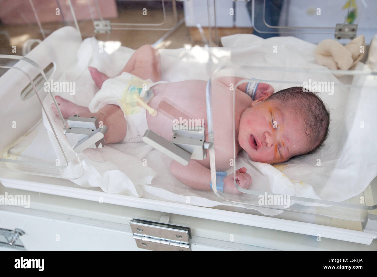 Newborn Baby On An Incubator Maternity Department Cochin Hospital Paris France Stock Photo Alamy