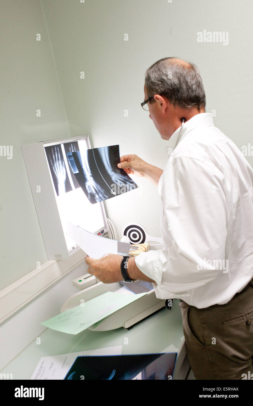 X ray hands arthritis hires stock photography and images Alamy