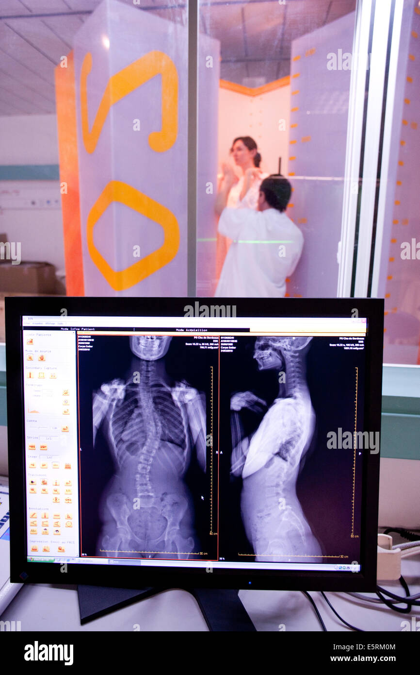 EOS biplanar Xray scanner, this 2D and 3D digital Xray imaging