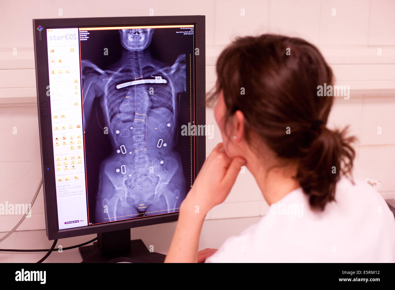EOS biplanar X-ray scanner, this 2D and 3D digital X-ray imaging equipment  is dedicated to the orthopedic practice and permits Stock Photo - Alamy