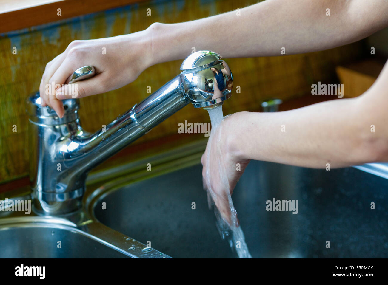 Woman treating superficial hand burn with cold water. Stock Photo