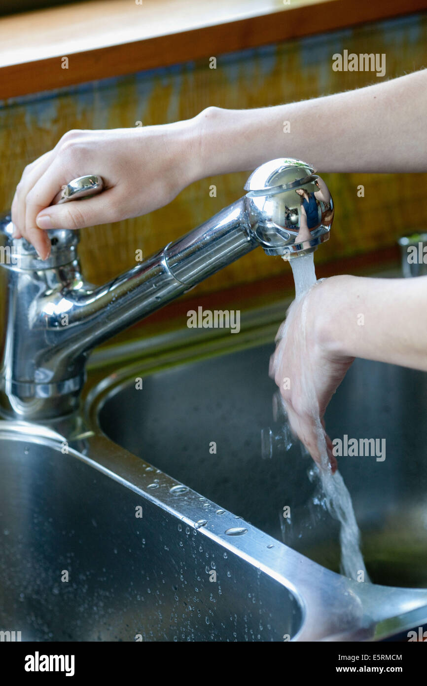 Woman treating superficial hand burn with cold water. Stock Photo