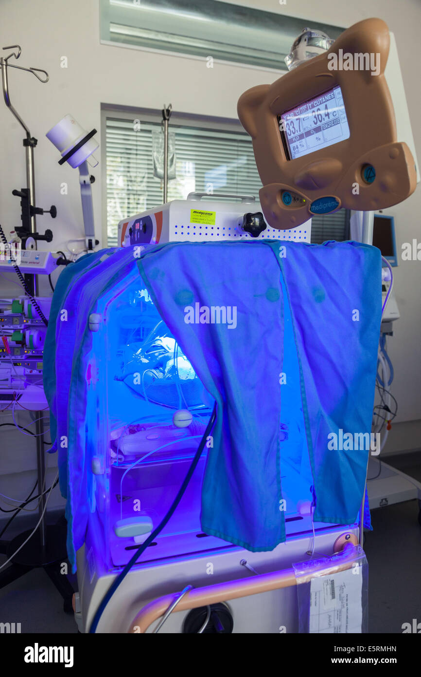 Newborn baby undergoing ultraviolet light treatment for jaundice
