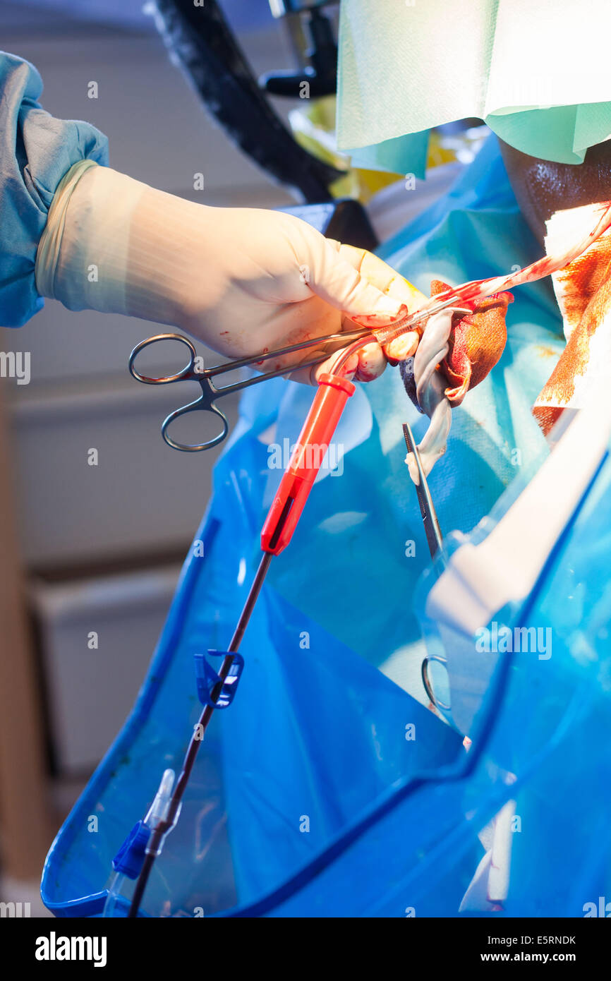 Harvesting umbilical cord stem cells. Midwife collecting blood from an umbilical cord. Obstetrics and gynaecology department, Stock Photo