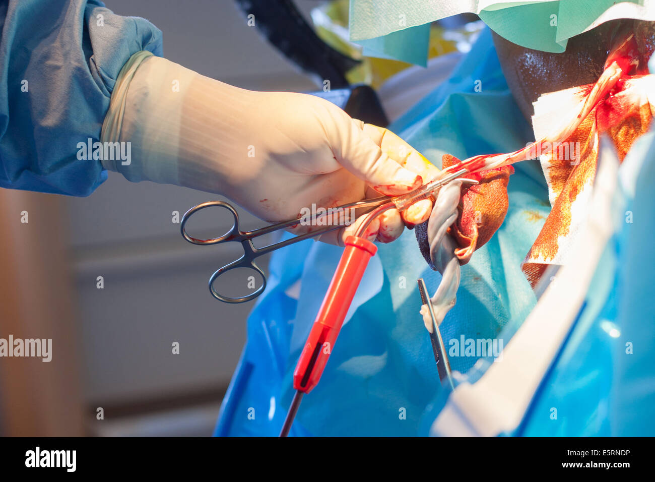 Harvesting umbilical cord stem cells. Midwife collecting blood from an umbilical cord. Obstetrics and gynaecology department, Stock Photo