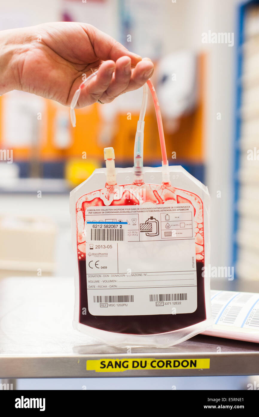 Umbilical cord blood for stem cell harvesting. Bag of placental blood. Obstetrics and gynaecology department, Limoges hospital, Stock Photo