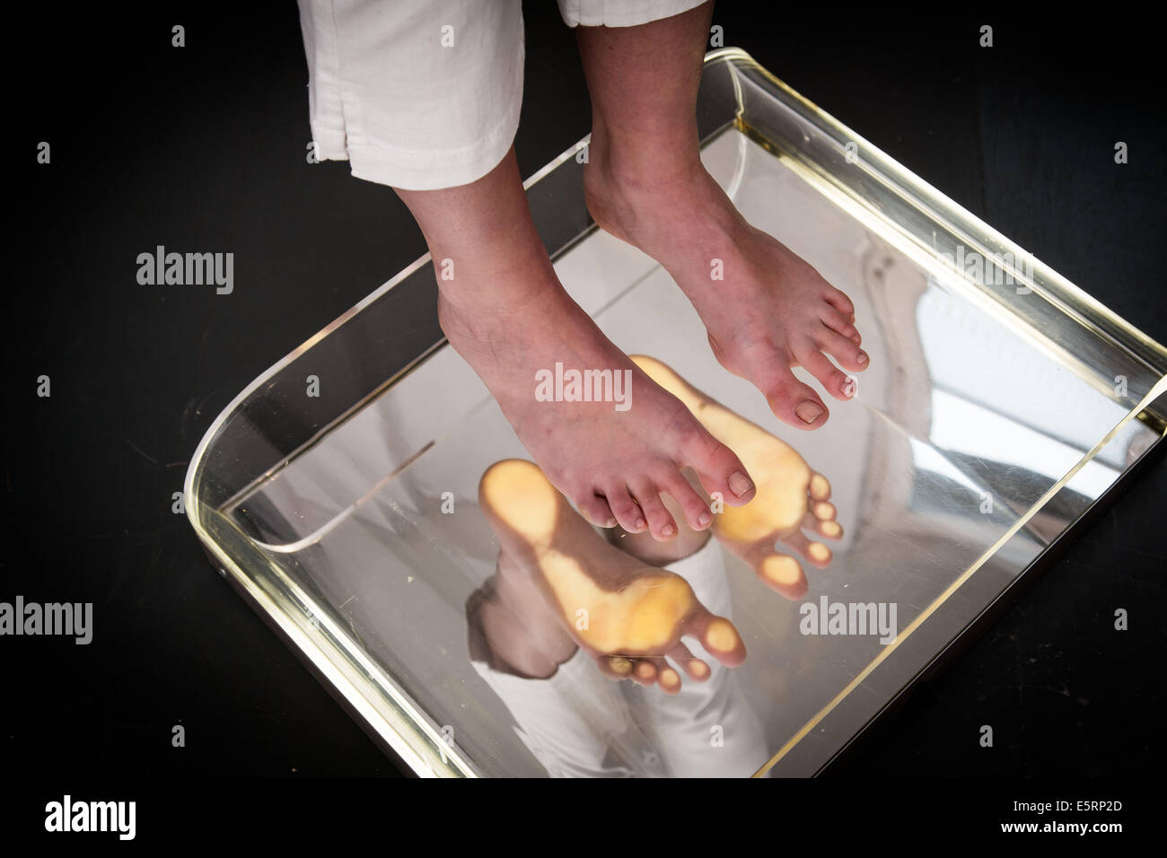 Examination of the sole of a female patient's feet with a podoscope. Stock Photo
