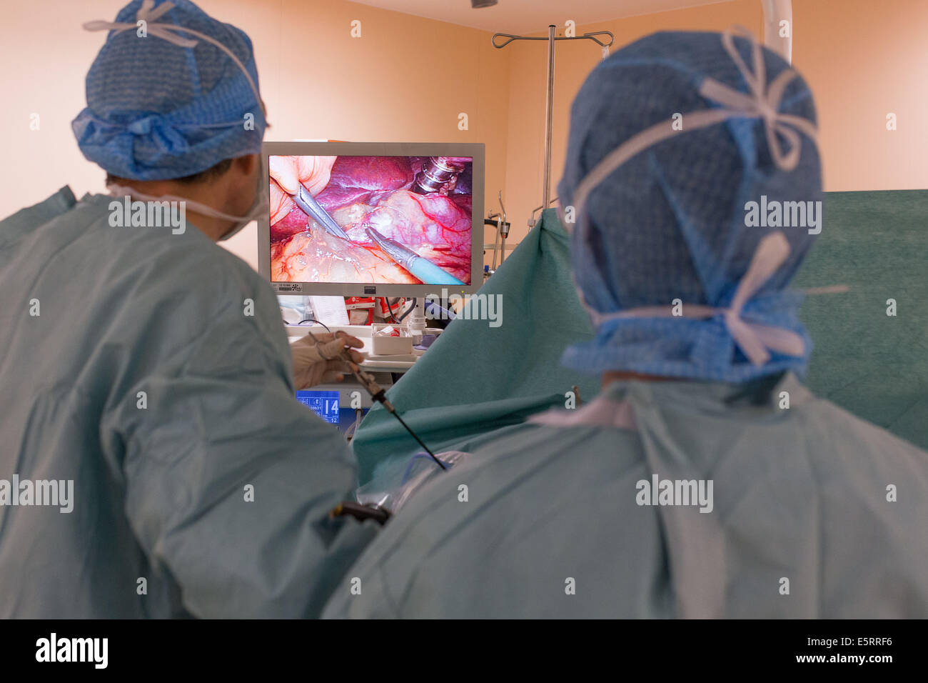 Surgeon performing a Laparoscopic Sleeve Gastrectomy, Limoges hospital