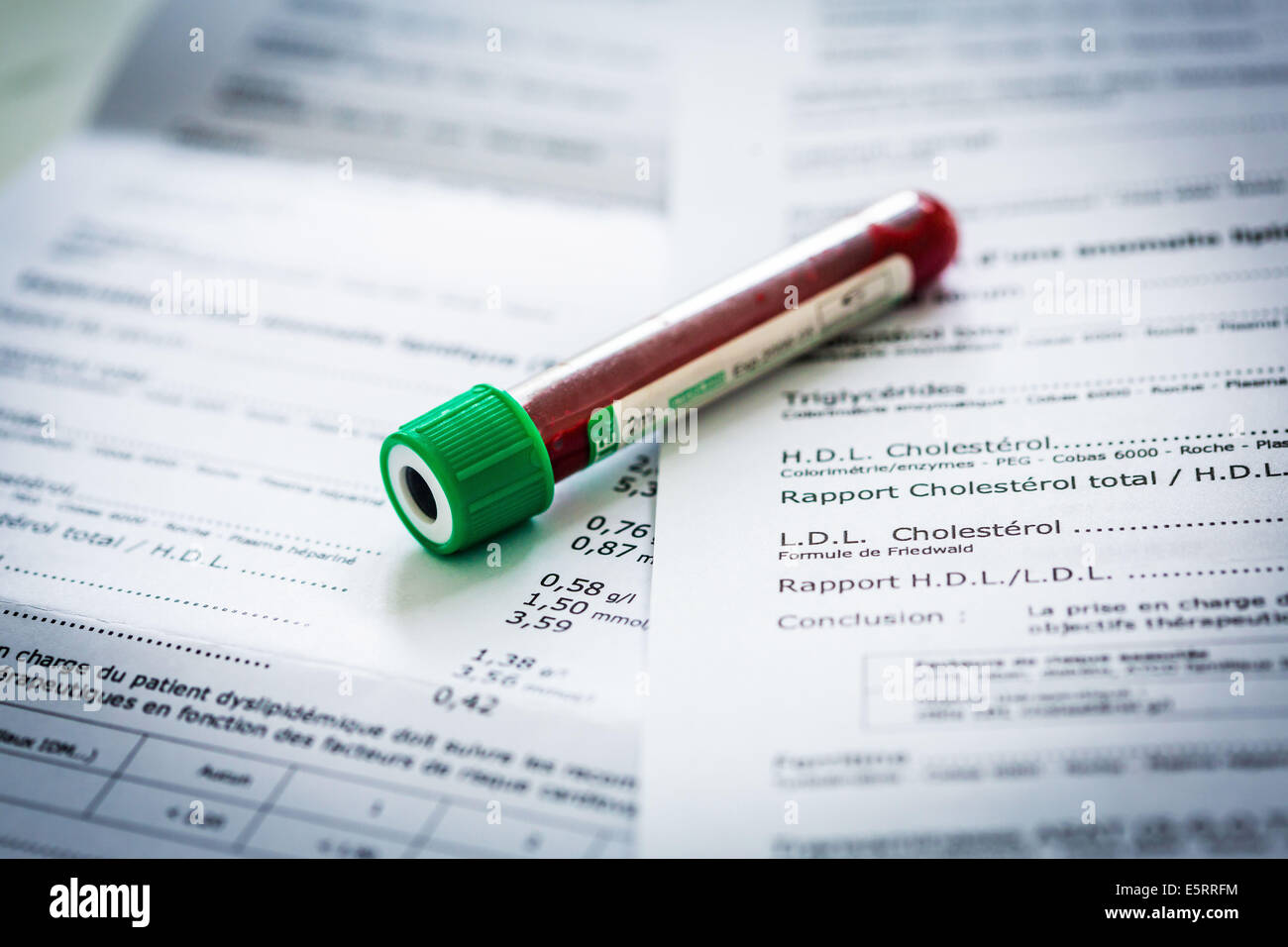 Lipid blood test result sheet with blood sample. Stock Photo