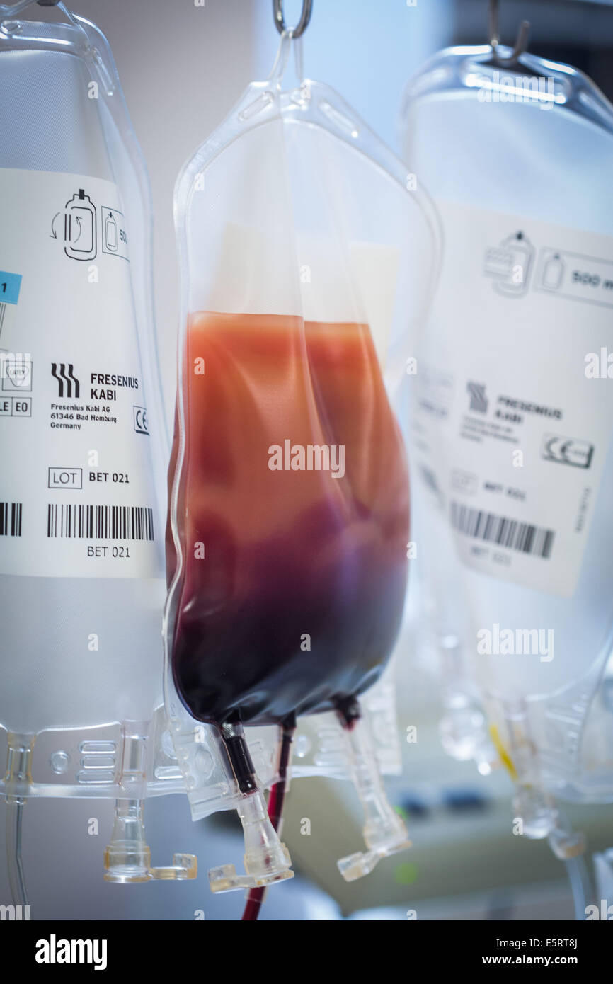 Blood bag containing peripheral blood stem cell (PBSC) donation by apheresis, Centre de transfusion sanguine des armées (CTSA) Stock Photo