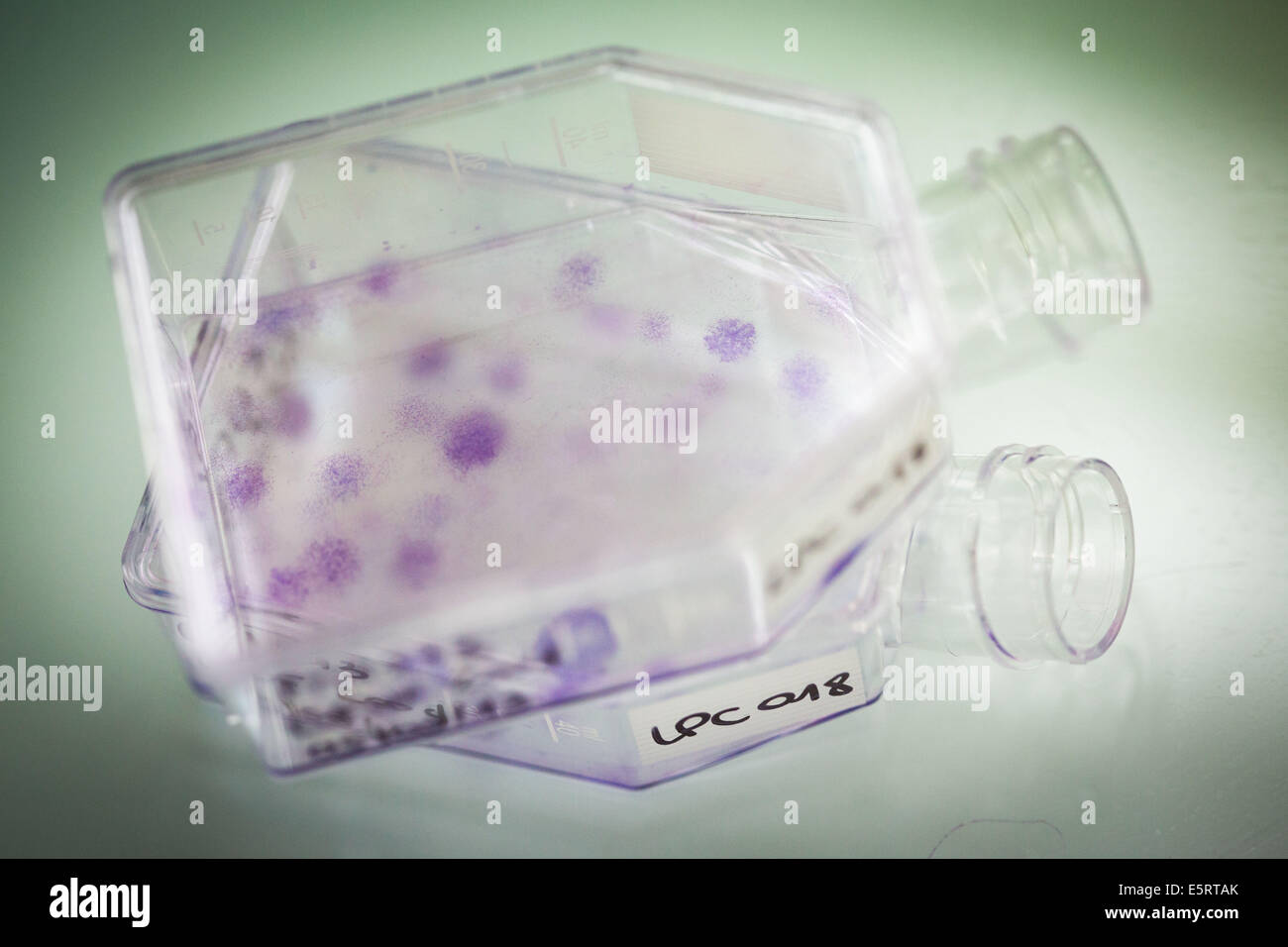 Cultures of clonogenic Mesenchymal Stem Cells (MSC), colonies of cells are stained purple. Stock Photo