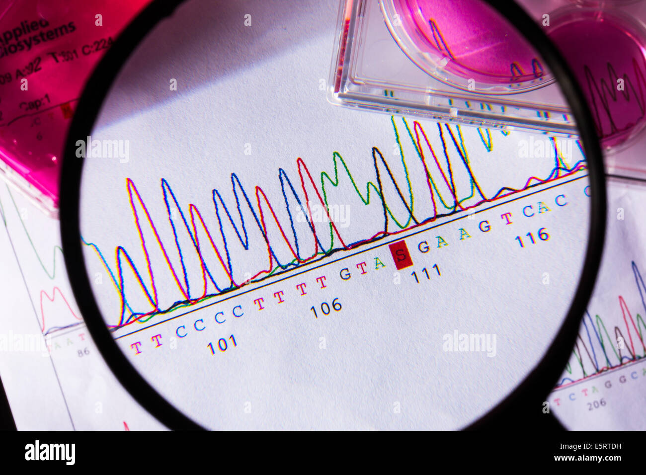 Magnifying glass over graphs showing the results of DNA (deoxyribonucleic acid) sequencing. Stock Photo
