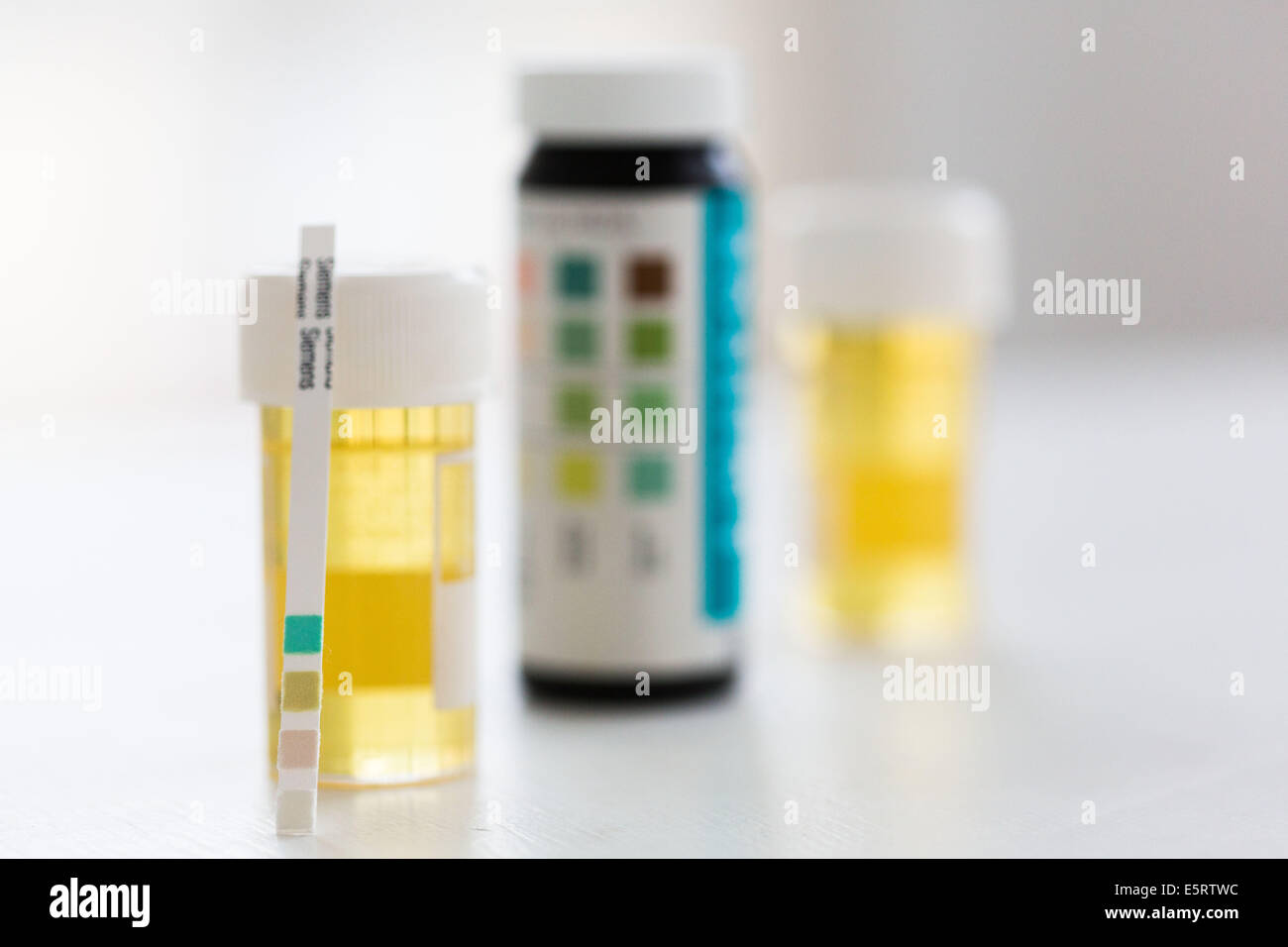 Urine sample with a test strip showing the results. This urine analysis