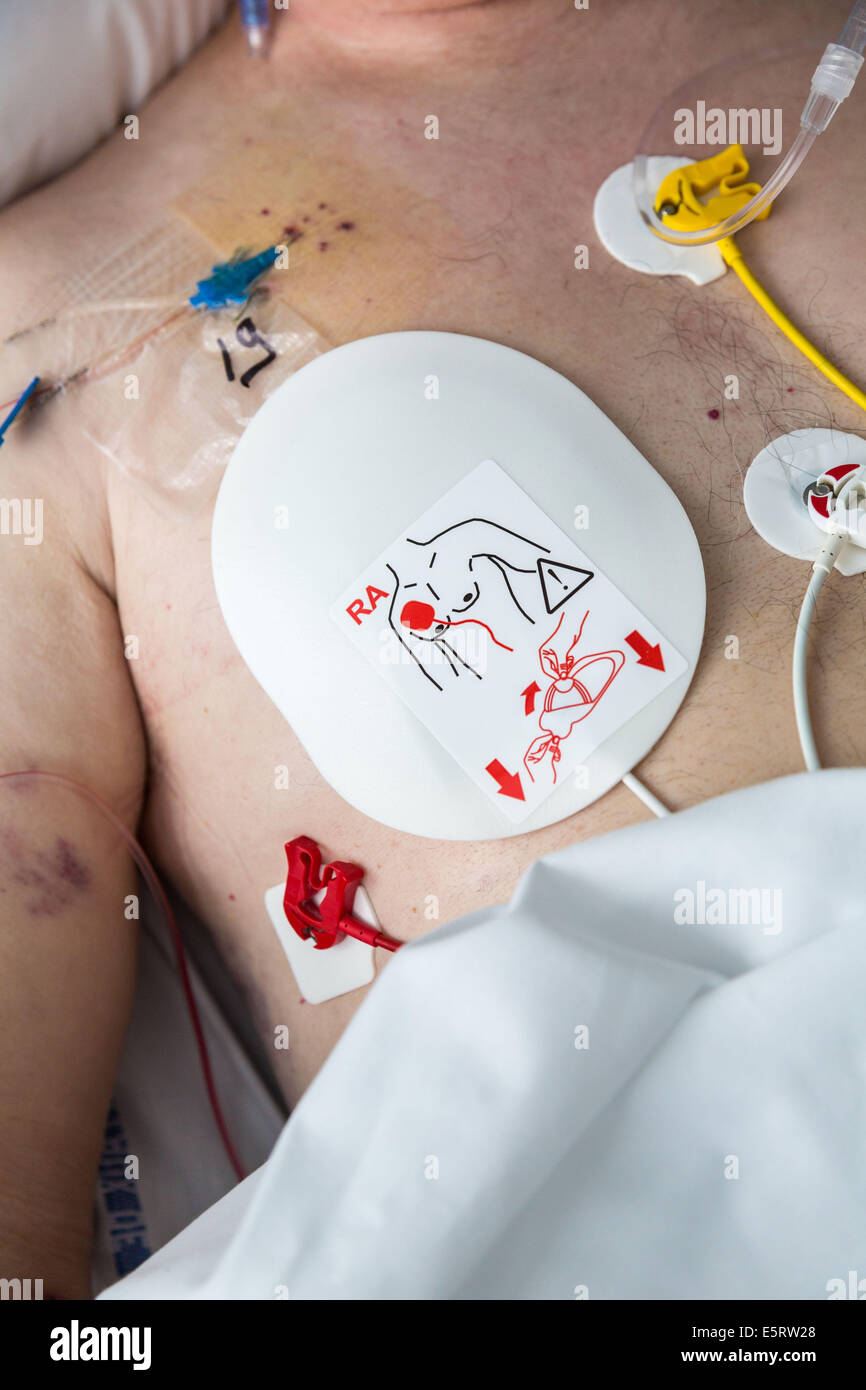 Defibrillation electrode, Intensive care department, Lagny Marne-la ...