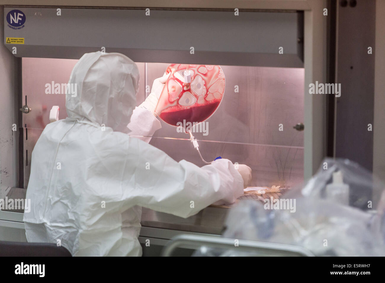 Technician preparing a hematopoietic stem cells bag , Cell Therapy Unit, CTSA in Clamart, France. Stock Photo