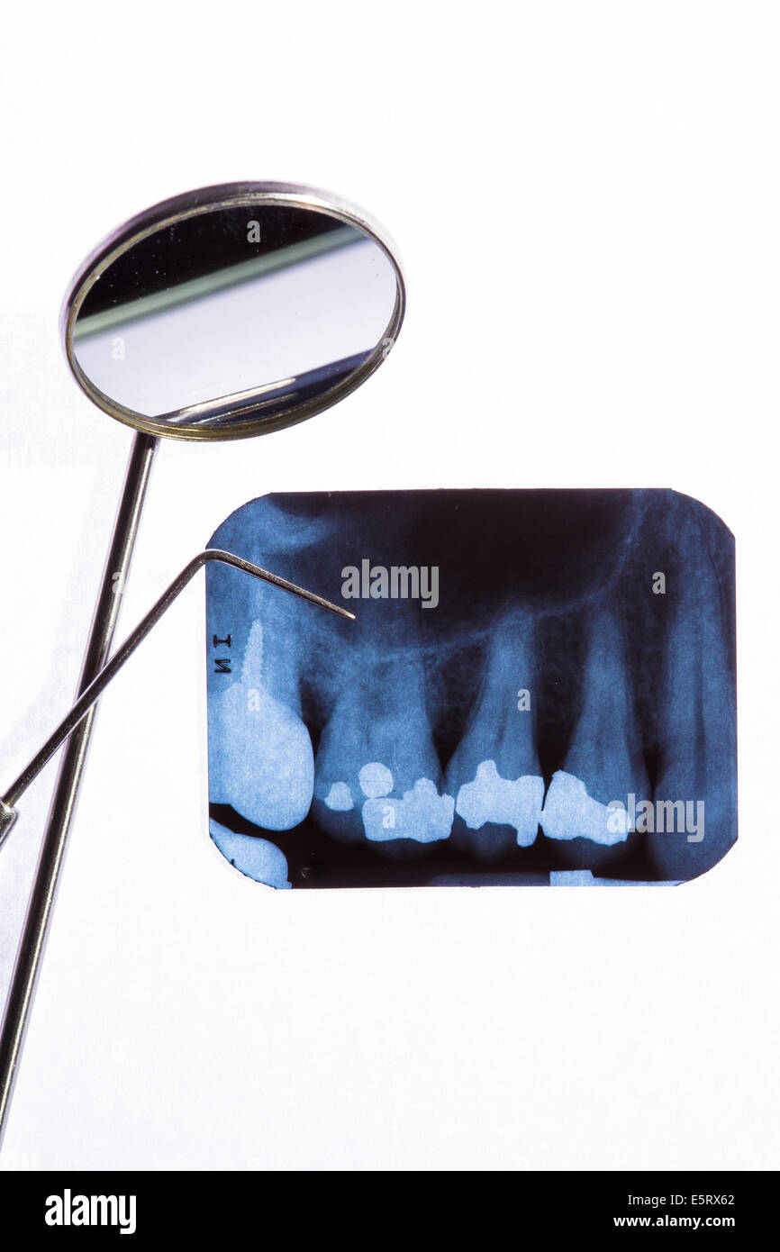 x-ray of teeth Stock Photo - Alamy