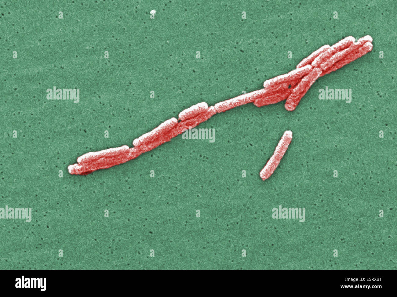 This scanning electron micrograph (SEM) depicted a number of red