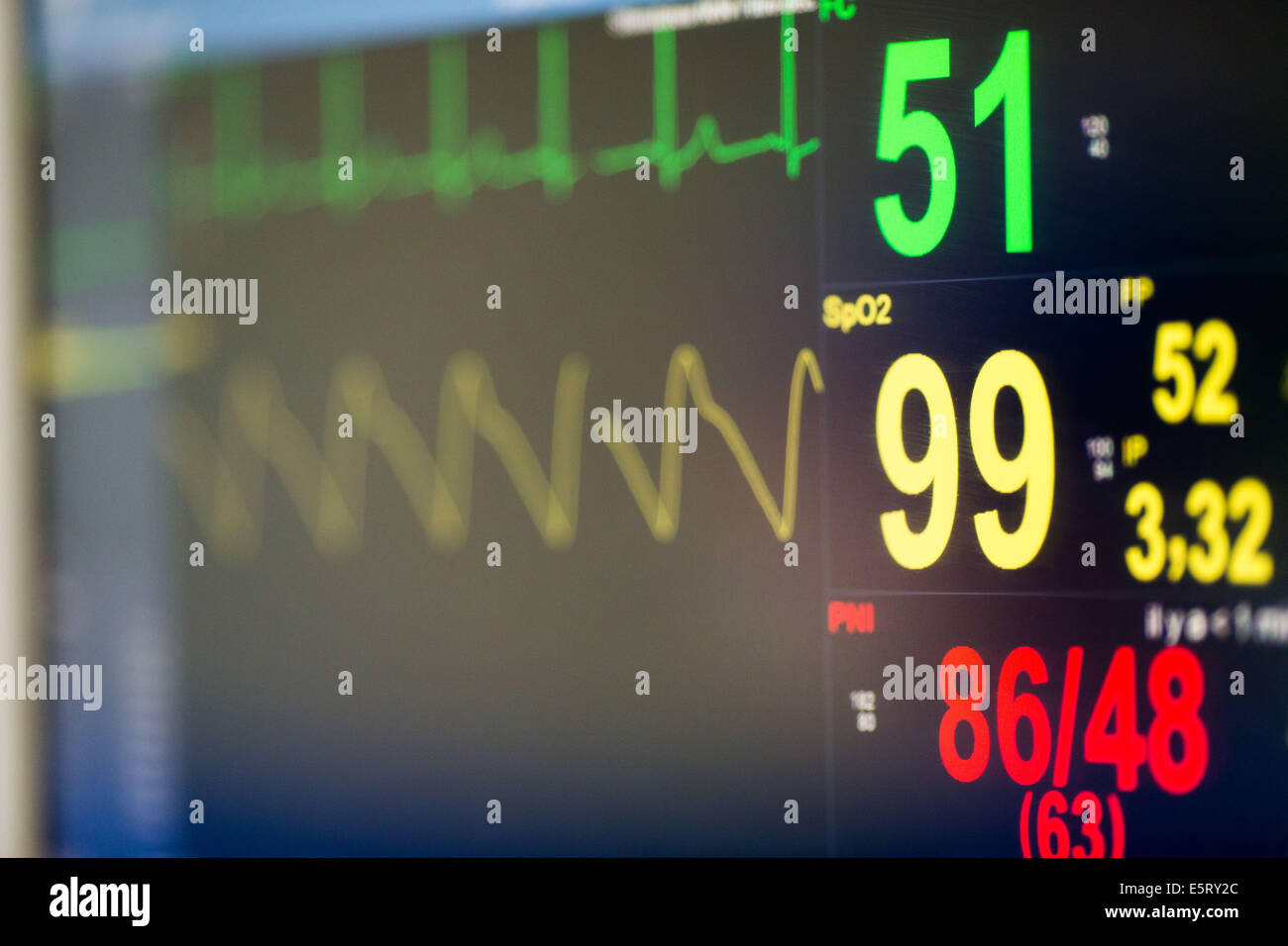 https://c8.alamy.com/comp/E5RY2C/monitoring-during-surgery-the-vital-signs-heart-rate-temperature-blood-E5RY2C.jpg