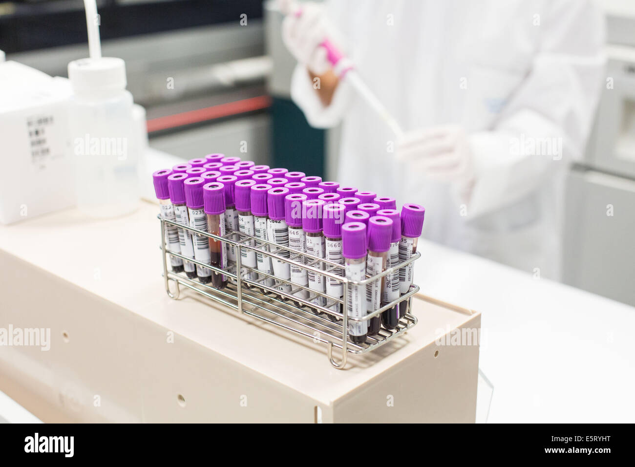 Blood samples in a medical laboratory. Stock Photo