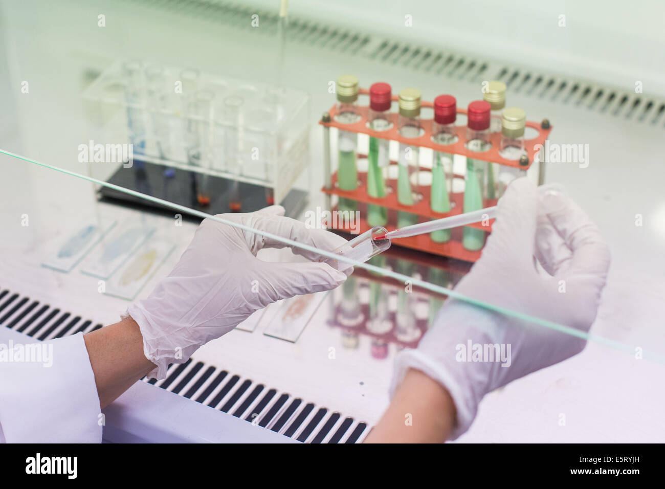 Fungus culture in test tubes under a laminar flow hood in a medical