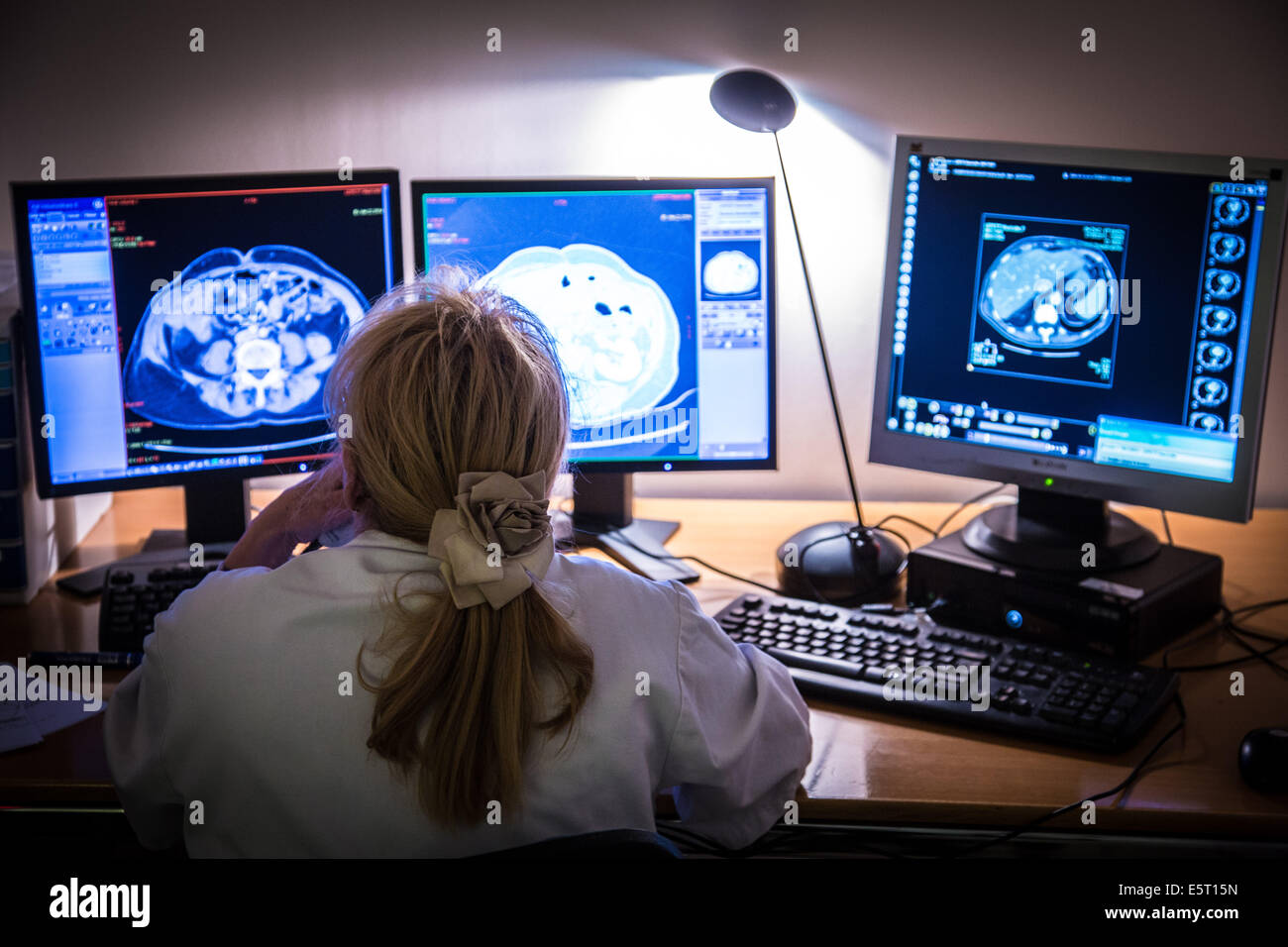 Radiologist studying CT-scans at Croix Saint Simon Hospital, Paris, France. Stock Photo