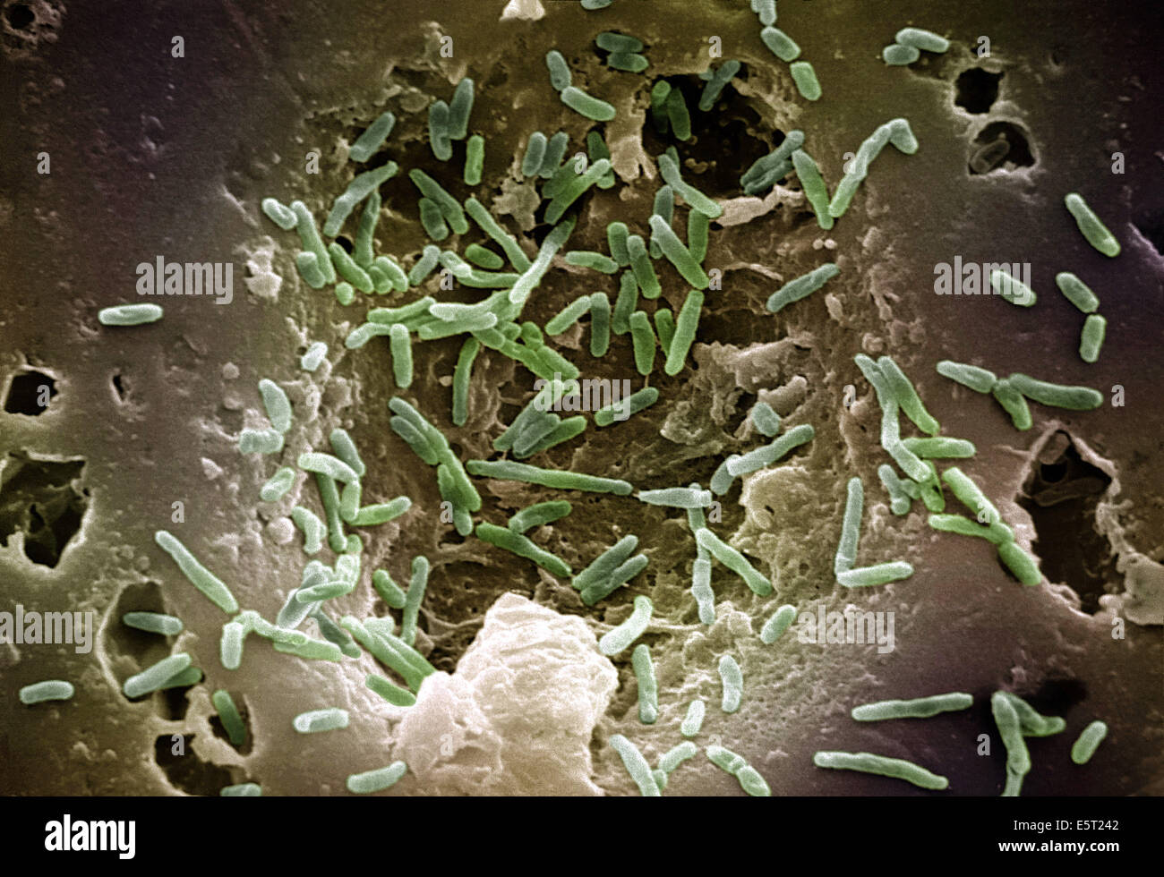 Scanning Electron Micrograph (SEM)of Mycobacterium chelonae, a bacterium causing postoperative wound infections in soft tissue Stock Photo