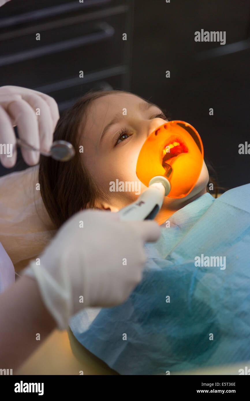 6 year old girl at the dentist, The dentist uses ultraviolet light to polymerize a photosensitive filling. Stock Photo