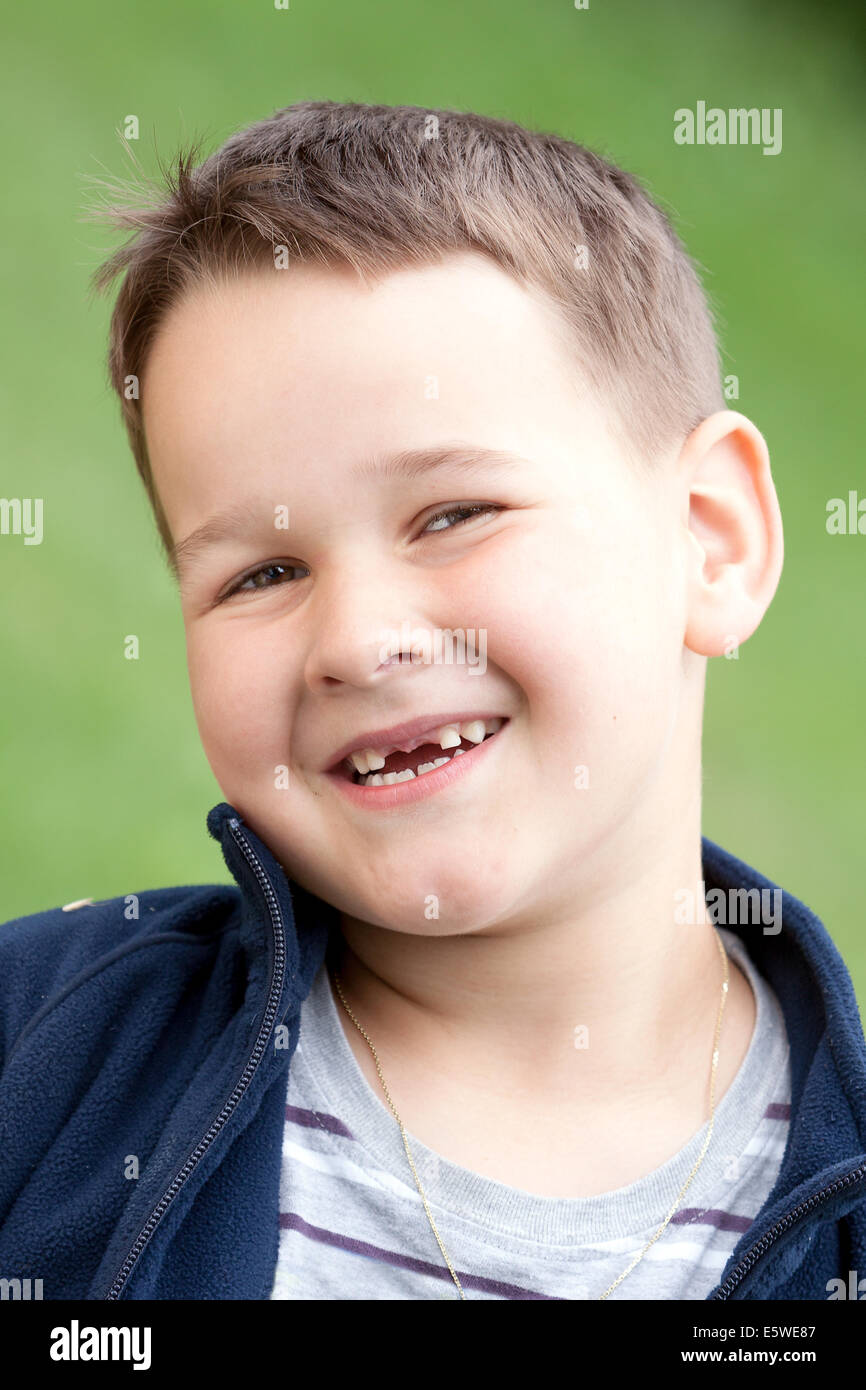 boy outdoors without upper two teeth with smile Stock Photo