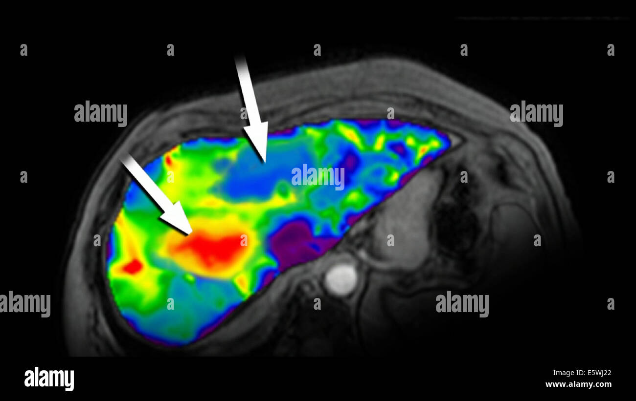 resonance elastography Stock Photo Alamy