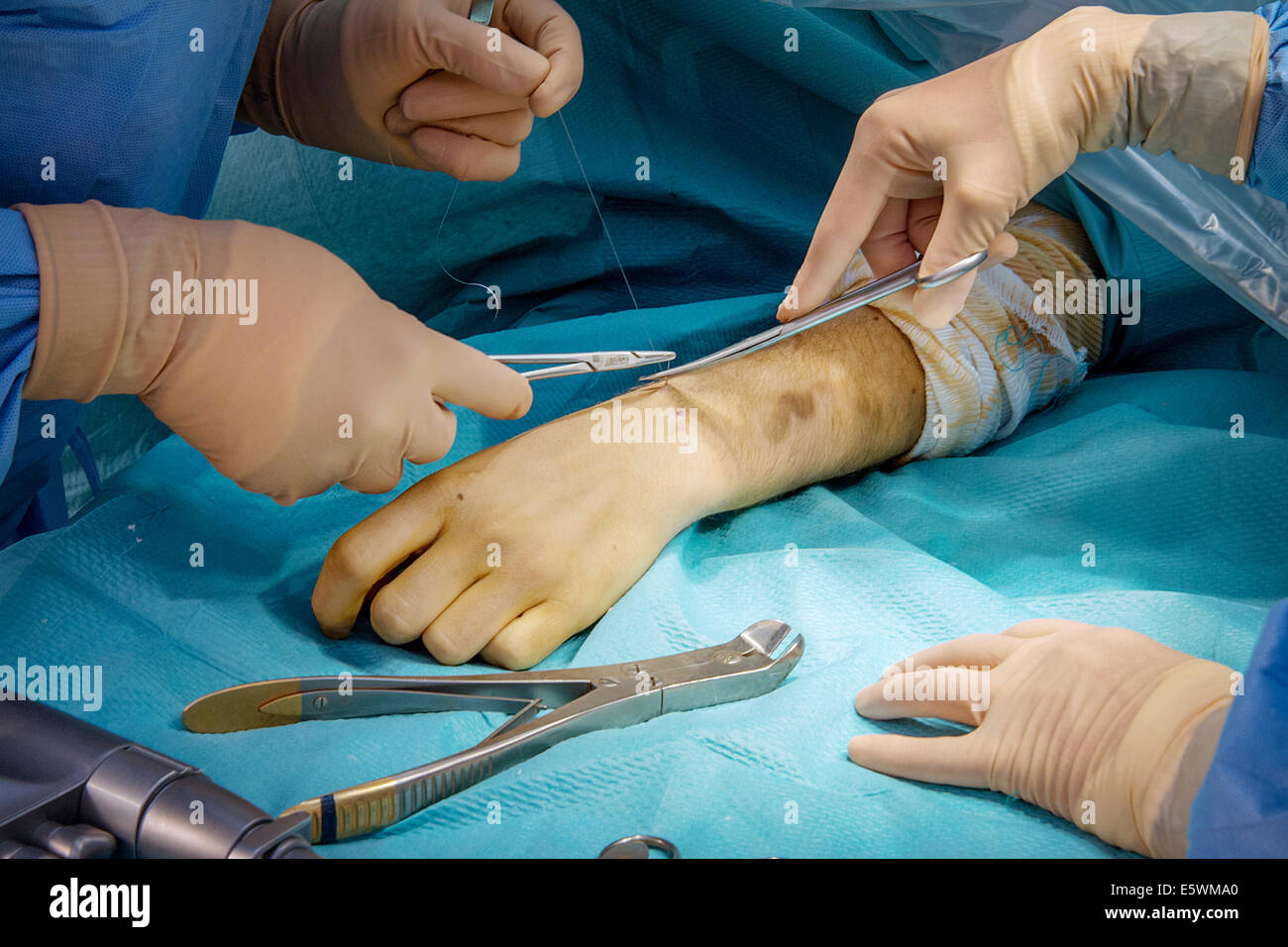 Orthopedic surgery Stock Photo