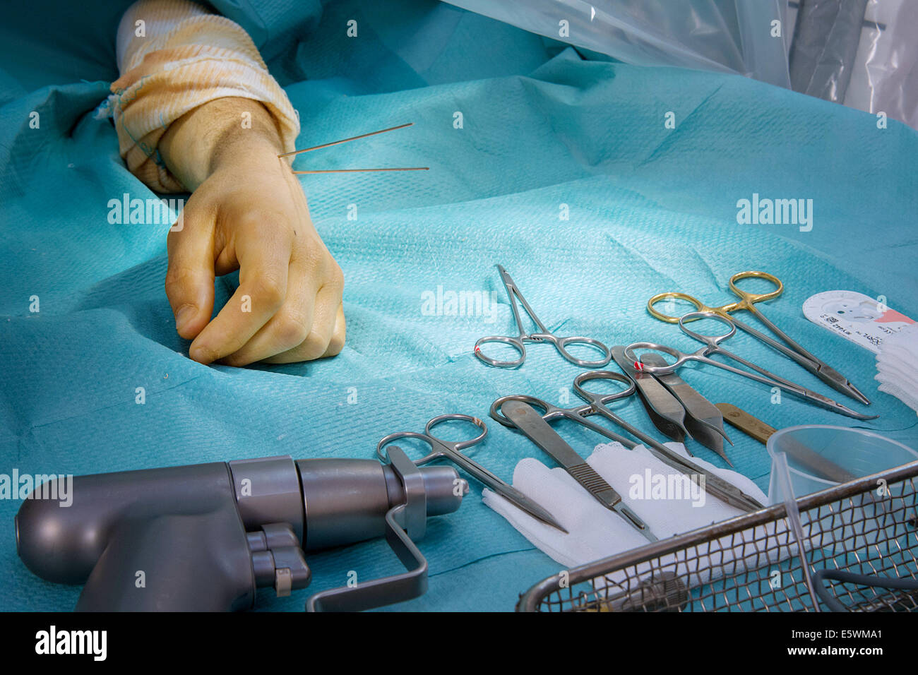 Hand and upper limb surgery hi-res stock photography and images - Alamy