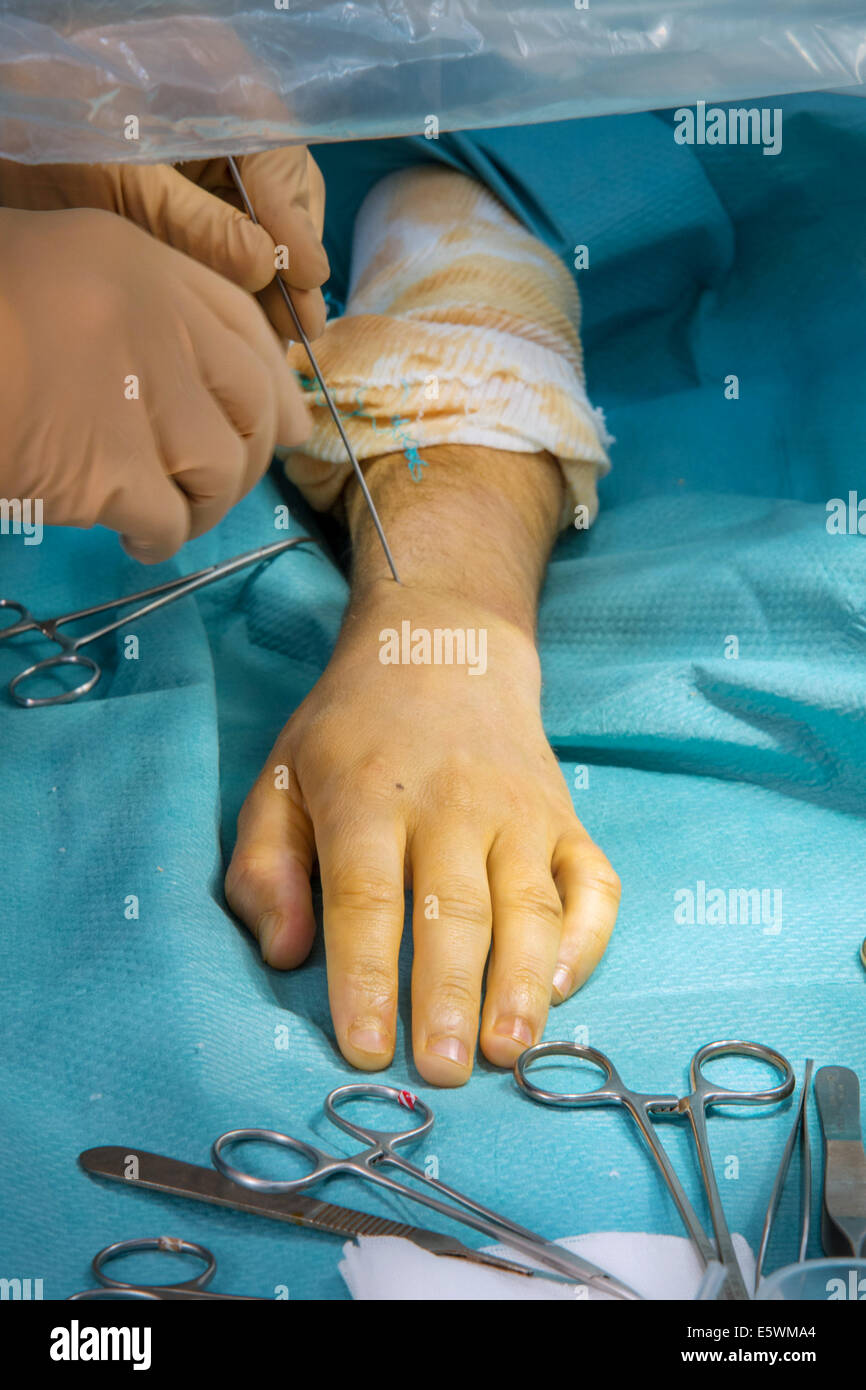 Orthopedic surgery Stock Photo