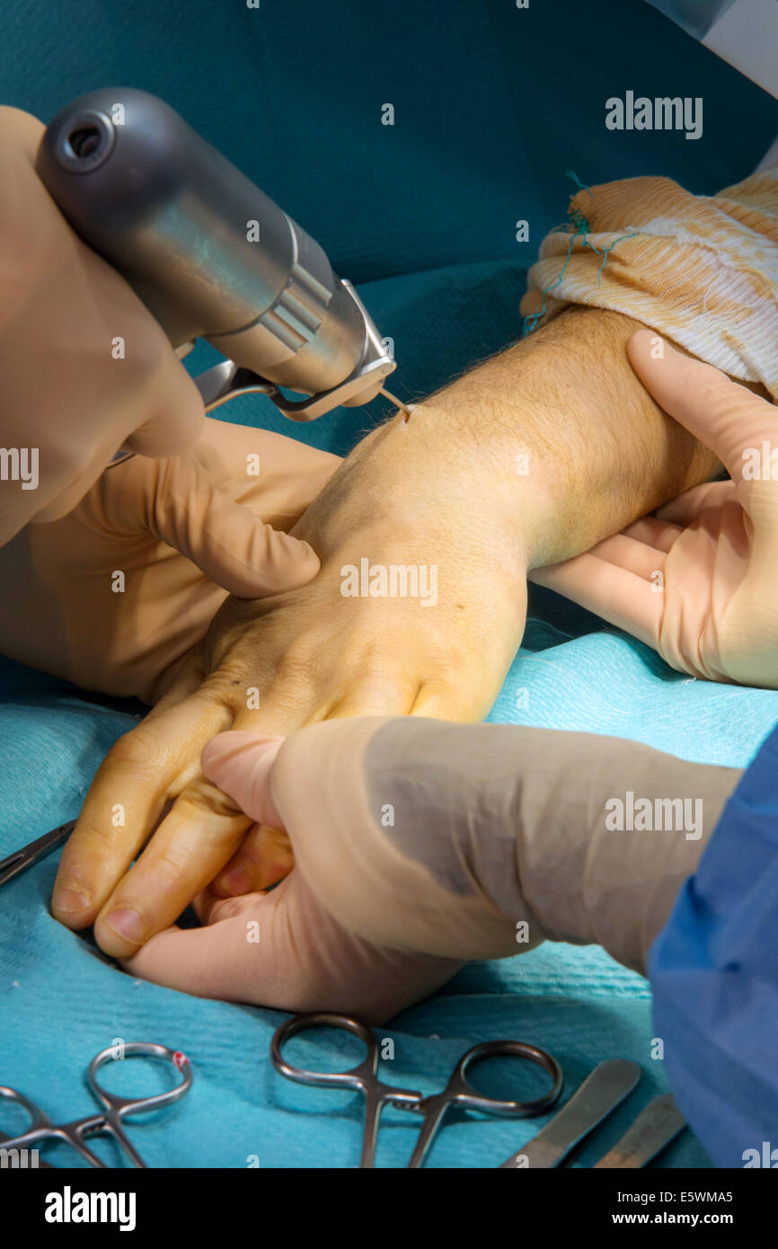 Orthopedic surgery Stock Photo