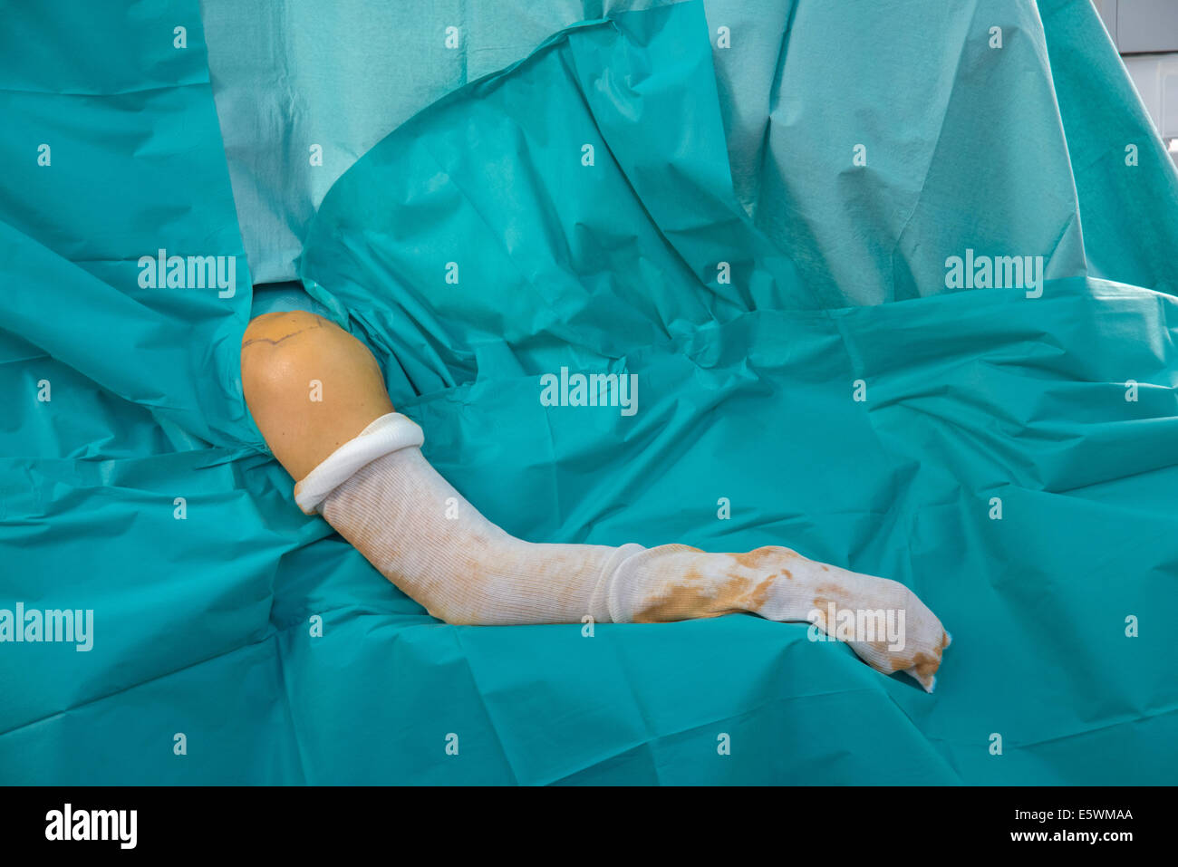 Orthopedic surgery Stock Photo