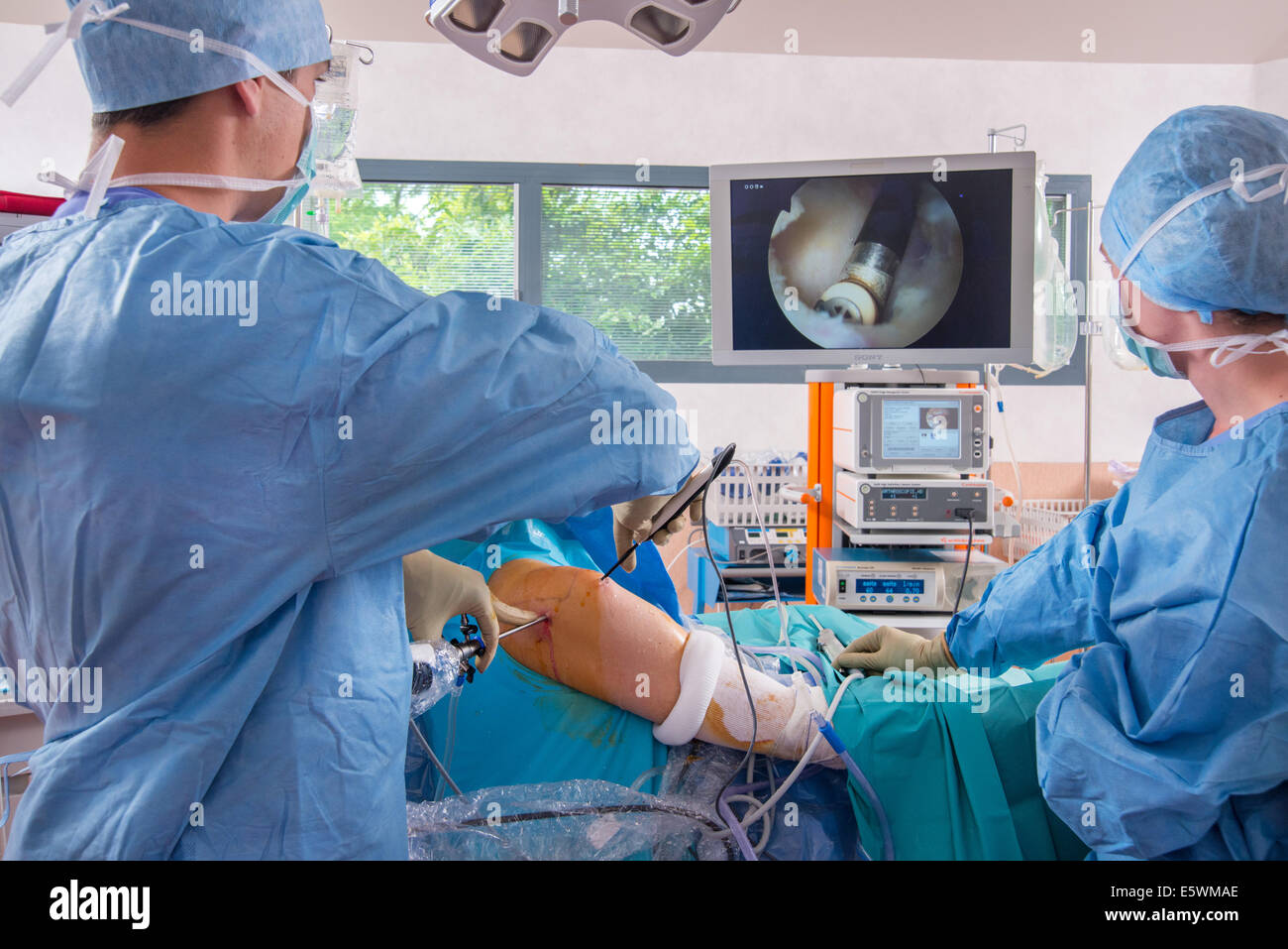 Shoulder, arthroscopy Stock Photo