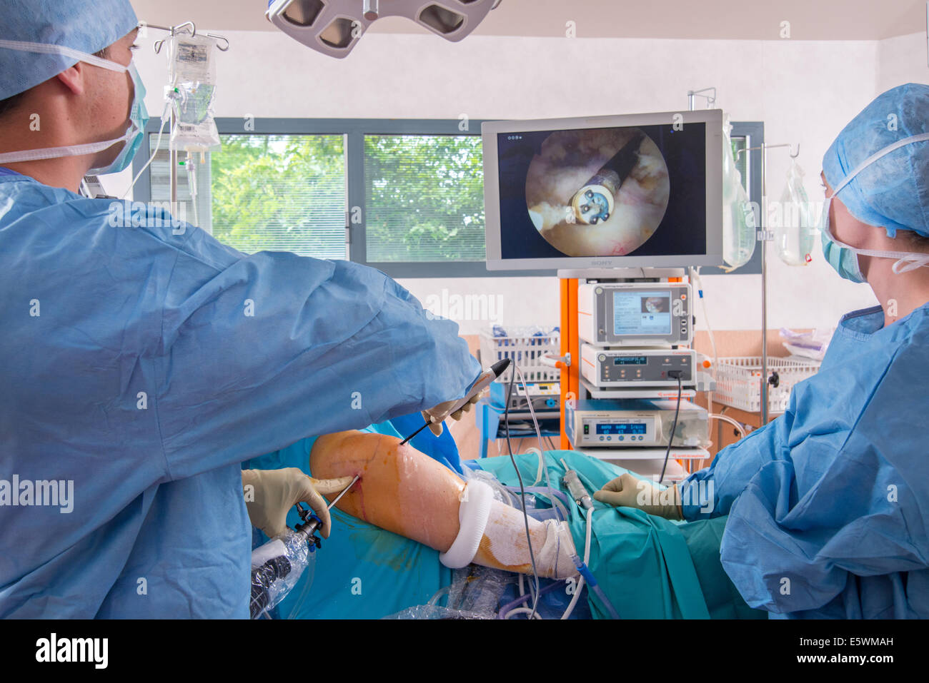 Shoulder arthroscopy hires stock photography and images Alamy