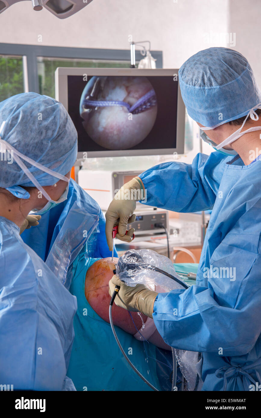 Shoulder, arthroscopy Stock Photo