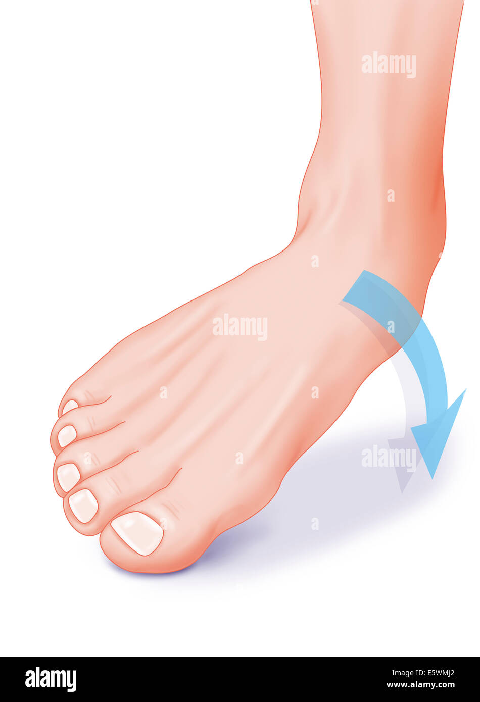 Sprained ankle drawing hi-res stock photography and images - Alamy
